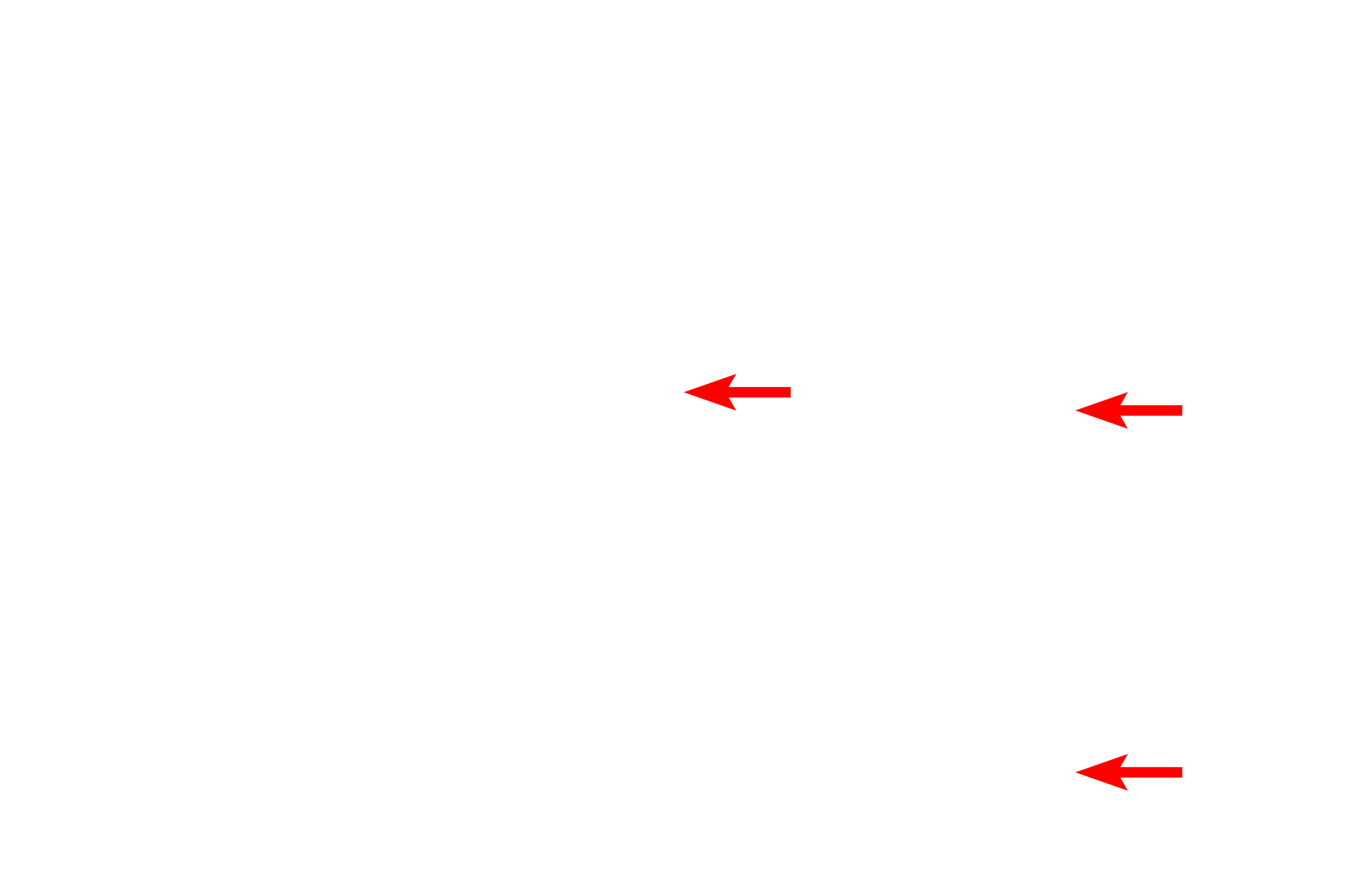 Peripheral chromatin <p>This very active plasma cell displays a characteristic nucleus containing peripherally located, coarsely clumped chromatin. Though not clearly visible in this image, the Golgi apparatus is present in the region of cytoplasm that is mostly devoid of rough endoplasmic reticulum. The widely distended cisternae of the rough endoplasmic reticulum indicate active protein synthesis.  10,000x</p>
