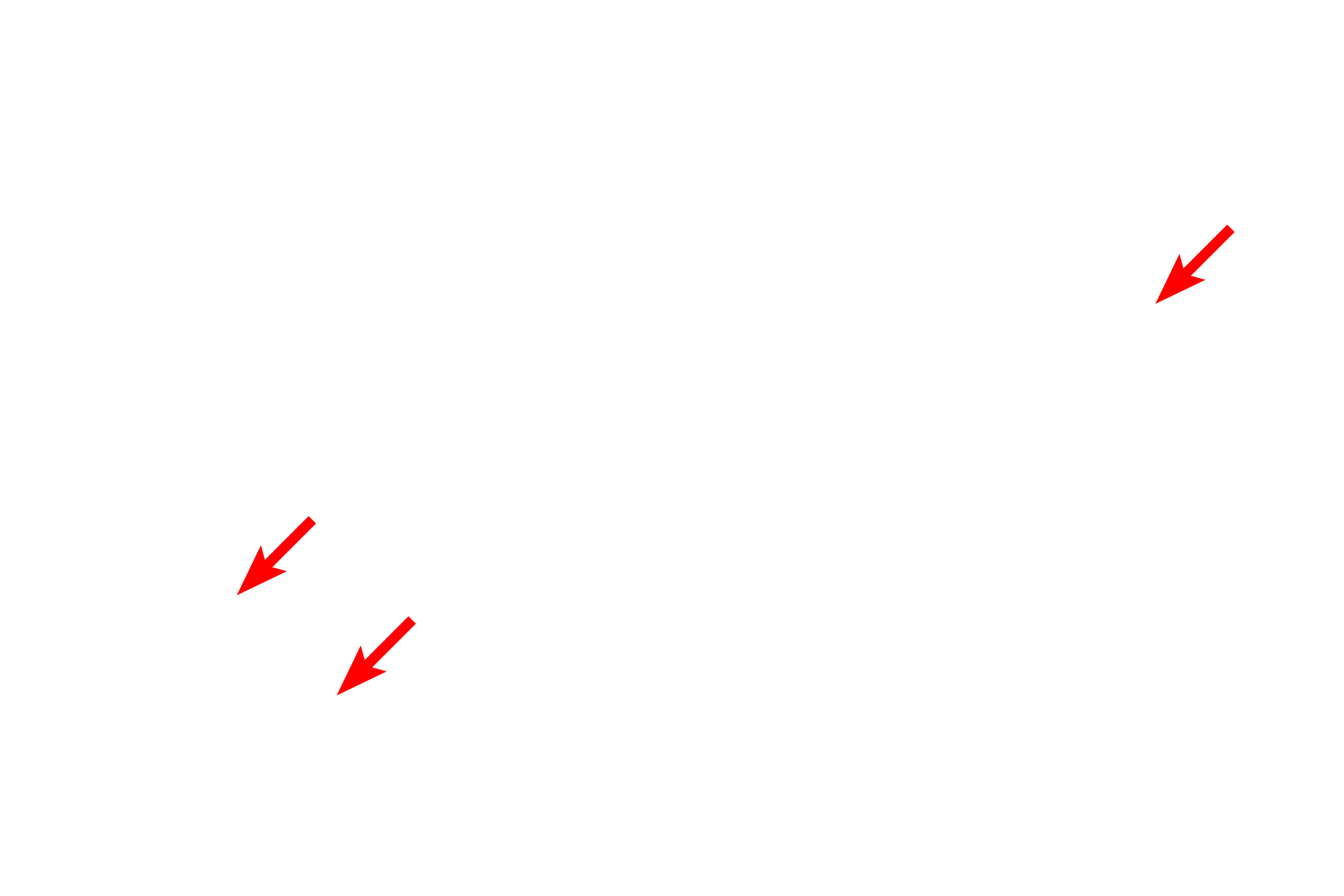 Rough endoplasmic reticulum <p>This very active plasma cell displays a characteristic nucleus containing peripherally located, coarsely clumped chromatin. Though not clearly visible in this image, the Golgi apparatus is present in the region of cytoplasm that is mostly devoid of rough endoplasmic reticulum. The widely distended cisternae of the rough endoplasmic reticulum indicate active protein synthesis.  10,000x</p>
