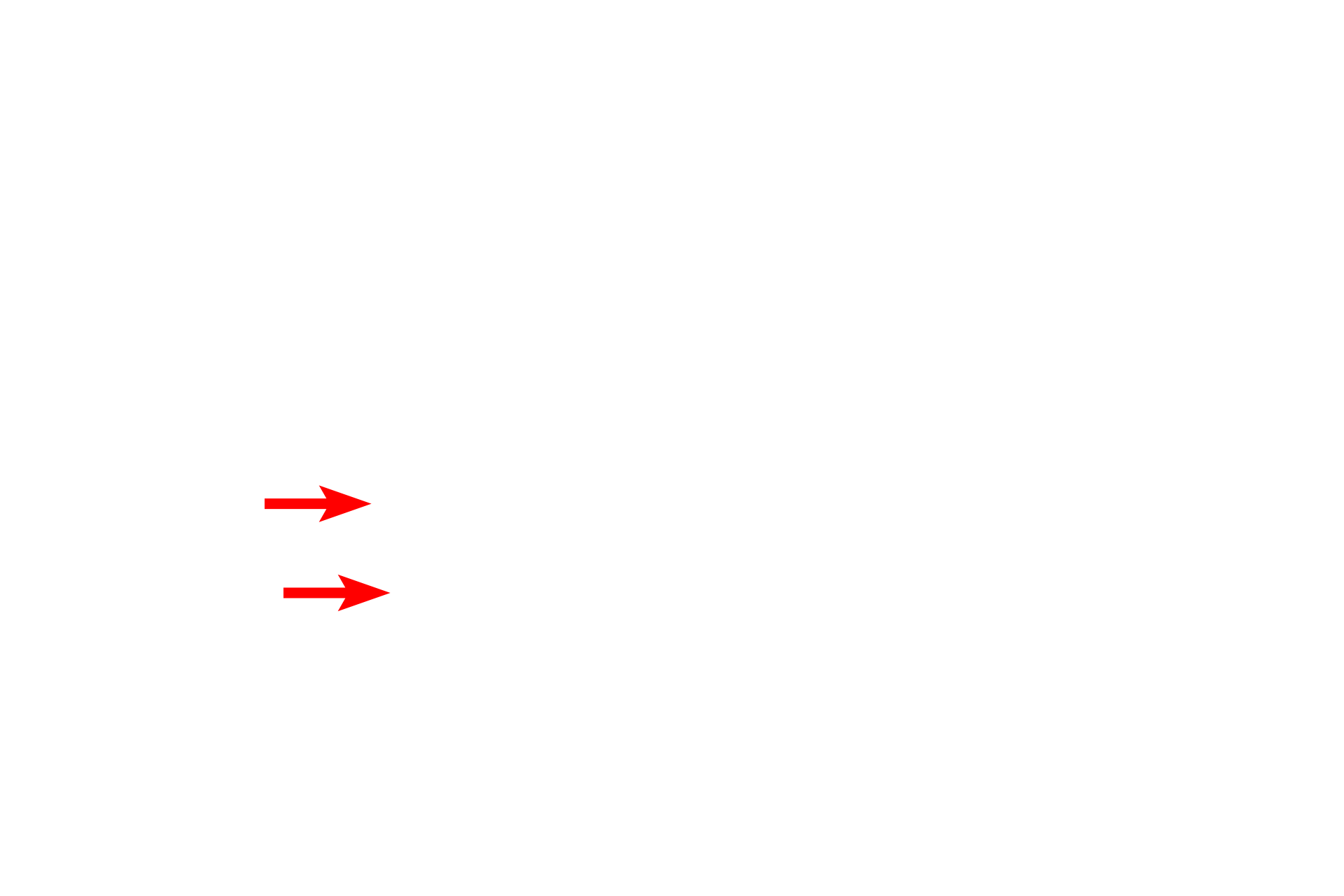Golgi <p>This very active plasma cell displays a characteristic nucleus containing peripherally located, coarsely clumped chromatin. Though not clearly visible in this image, the Golgi apparatus is present in the region of cytoplasm that is mostly devoid of rough endoplasmic reticulum. The widely distended cisternae of the rough endoplasmic reticulum indicate active protein synthesis.  10,000x</p>
