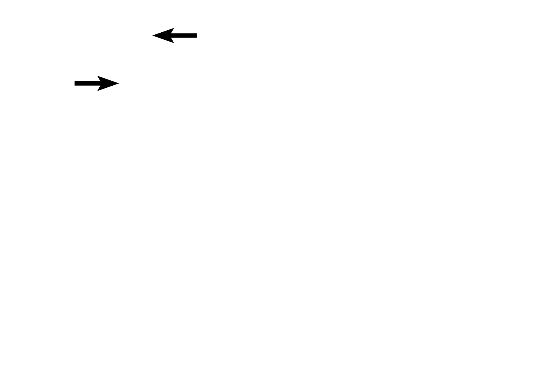  - Granules <p>A typical eosinophil is seen in this blood smear surrounded by red blood cells. The bilobed nucleus is clearly visible with the lobes connected by a thin chromatin strand (arrow).</p>

