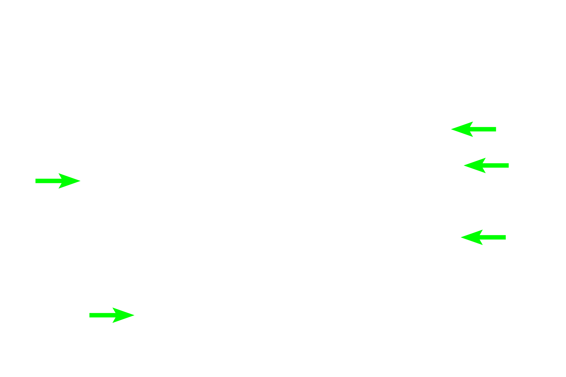 Eosinophils in tissue > <p>The morphological features of eosinophils are clearly evident in tissues, though the connection between the nuclear lobes is not always visible.</p>
