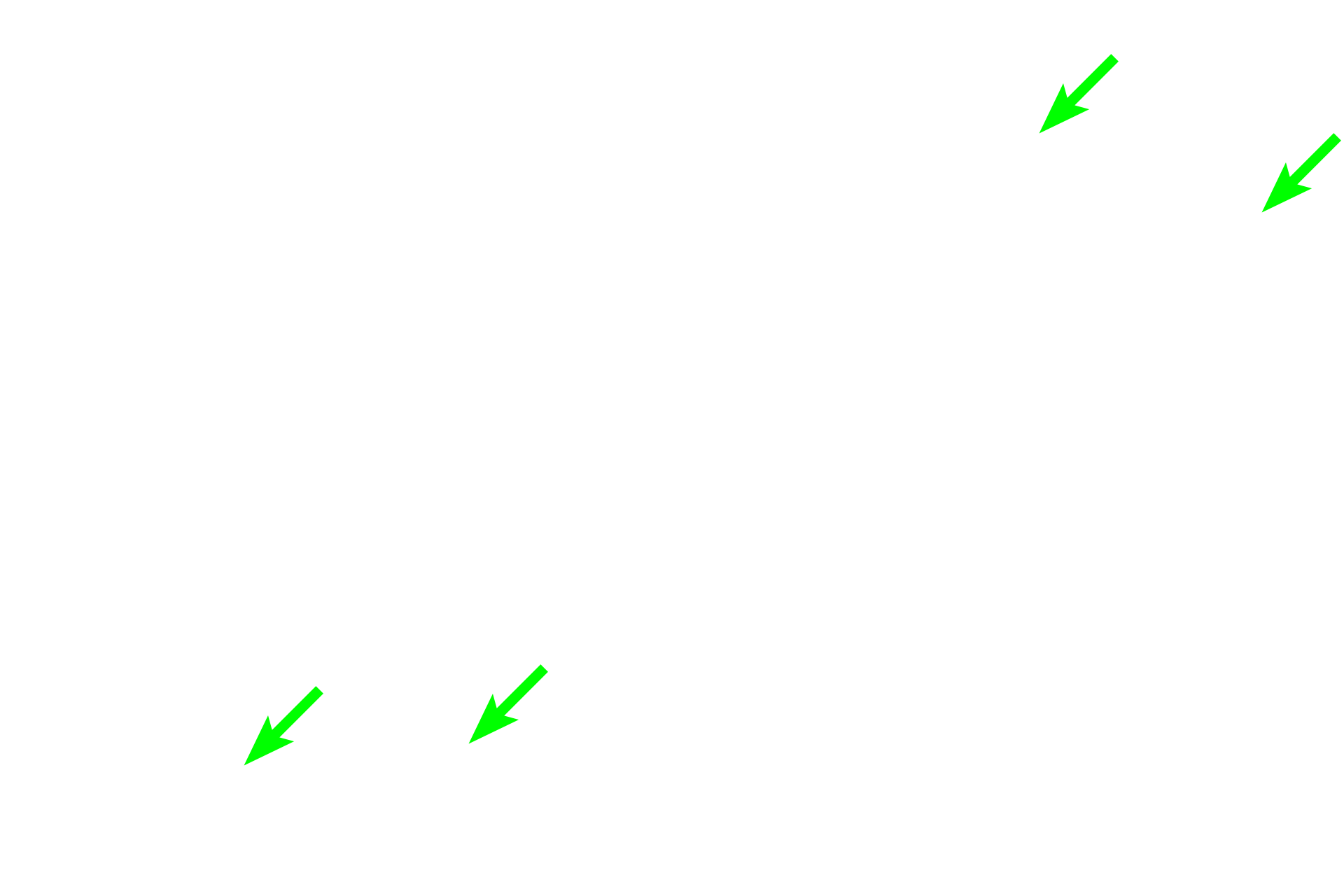 Plasma cells <p>The morphological features of eosinophils are clearly evident in tissues, though the connection between the nuclear lobes is not always visible.</p>
