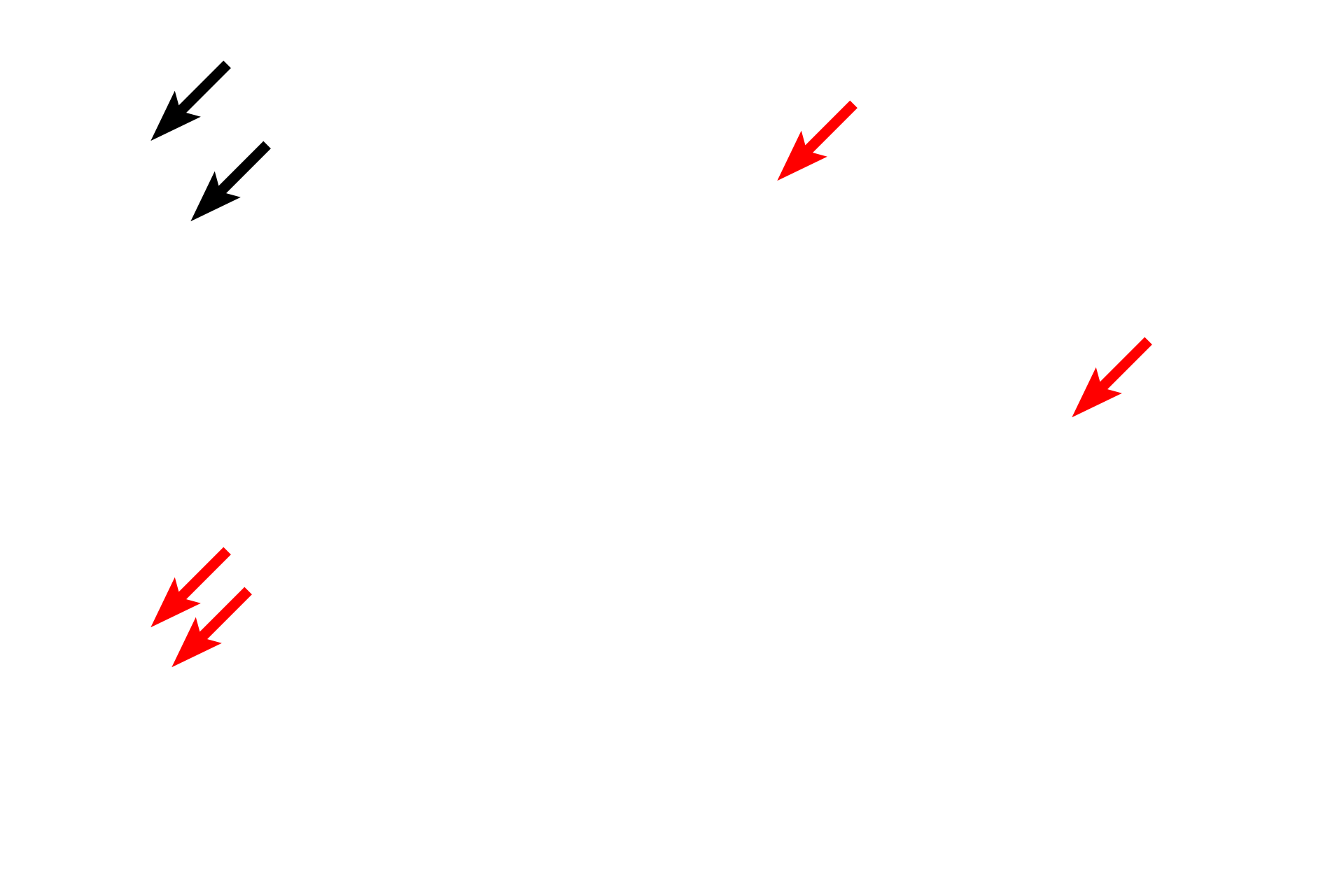 Bilobed nucleus <p>These micrographs show the cellular components of eosinophils. Note the bilobed nucleus with lobes connected by a thin region of chromatin. Like all granular leucocytes, eosinophils have both azurophilic (primary) granules and specific (secondary) granules. In eosinophils, the specific granules contain a large crystalloid body surrounded by an electron dense matrix. These granules stain intensely with eosin. The cytoplasm contains few other membranous organelles. 1000x, 10,000x</p>
