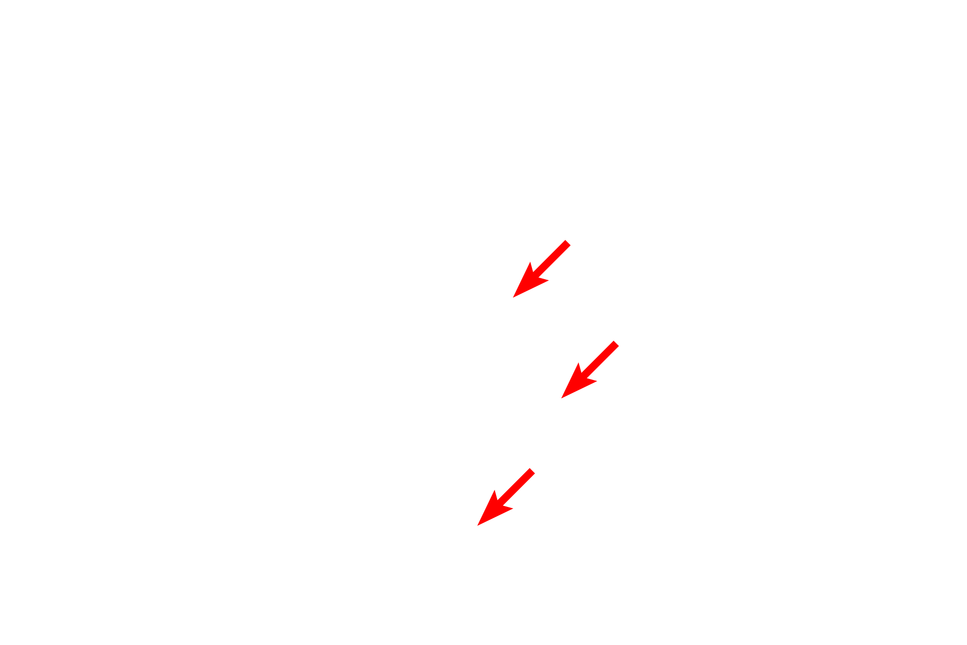  - Crystalloid bodies <p>The contents of the specific granules of eosinophils have powerful cytotoxic effects on protozoan and helminthic parasites. These granules stain intensely with eosin and contain a crystalloid body that is responsible for the refractivity of the granules seen by light microscopy.</p>

