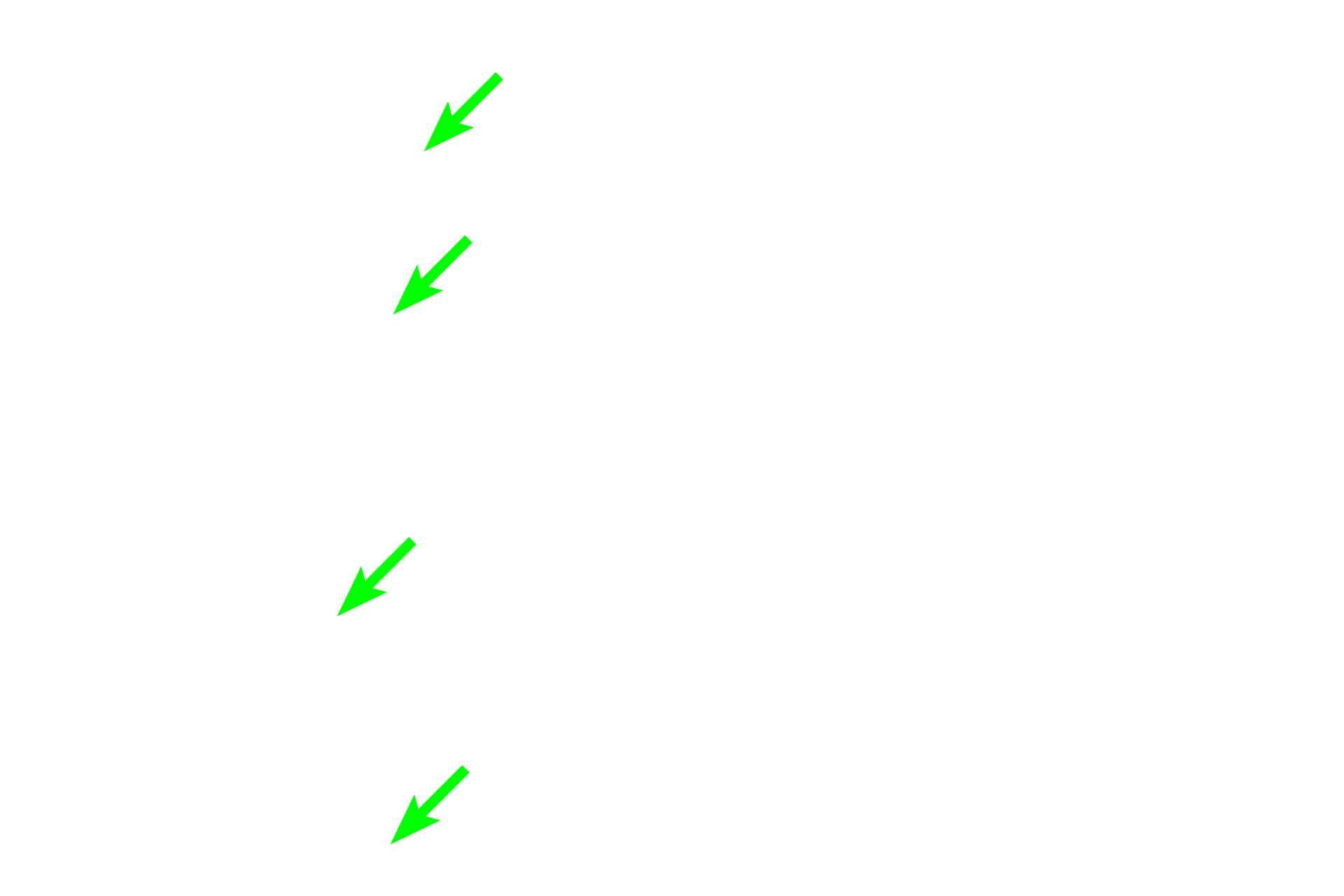 Lymphocytes <p>This image shows numerous lymphocytes in the connective tissue surrounding mammary glands in the breast.</p>
