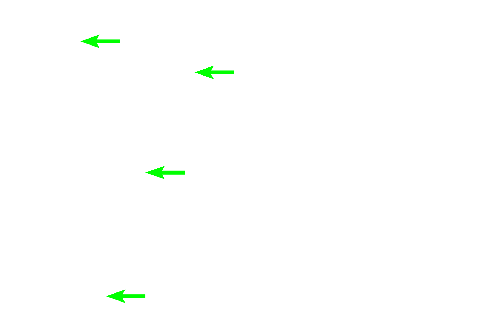 Mammary glands <p>This image shows numerous lymphocytes in the connective tissue surrounding mammary glands in the breast.</p>
