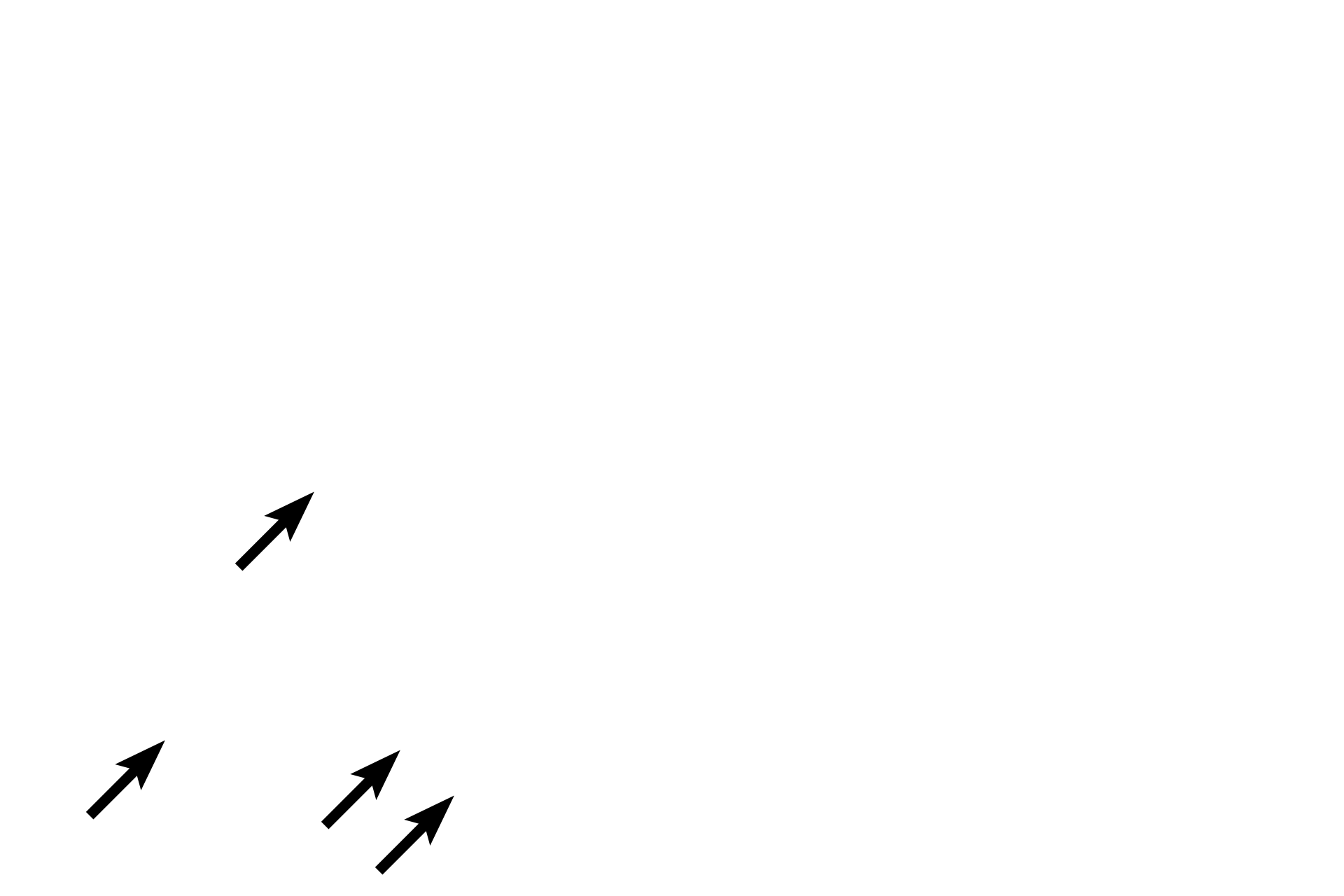  - Neutrophils <p>Neutrophils are frequently encountered in connective tissues, where they form the first line of defense. They are recruited from the blood stream in response to chemotactic factors released at sites of infection or tissue damage. Neutrophils are phagocytic and remove pathogens and cellular debris. Accumulation of dead neutrophils, bacteria and tissue debris form the whitish-yellow exudate called pus.</p>
