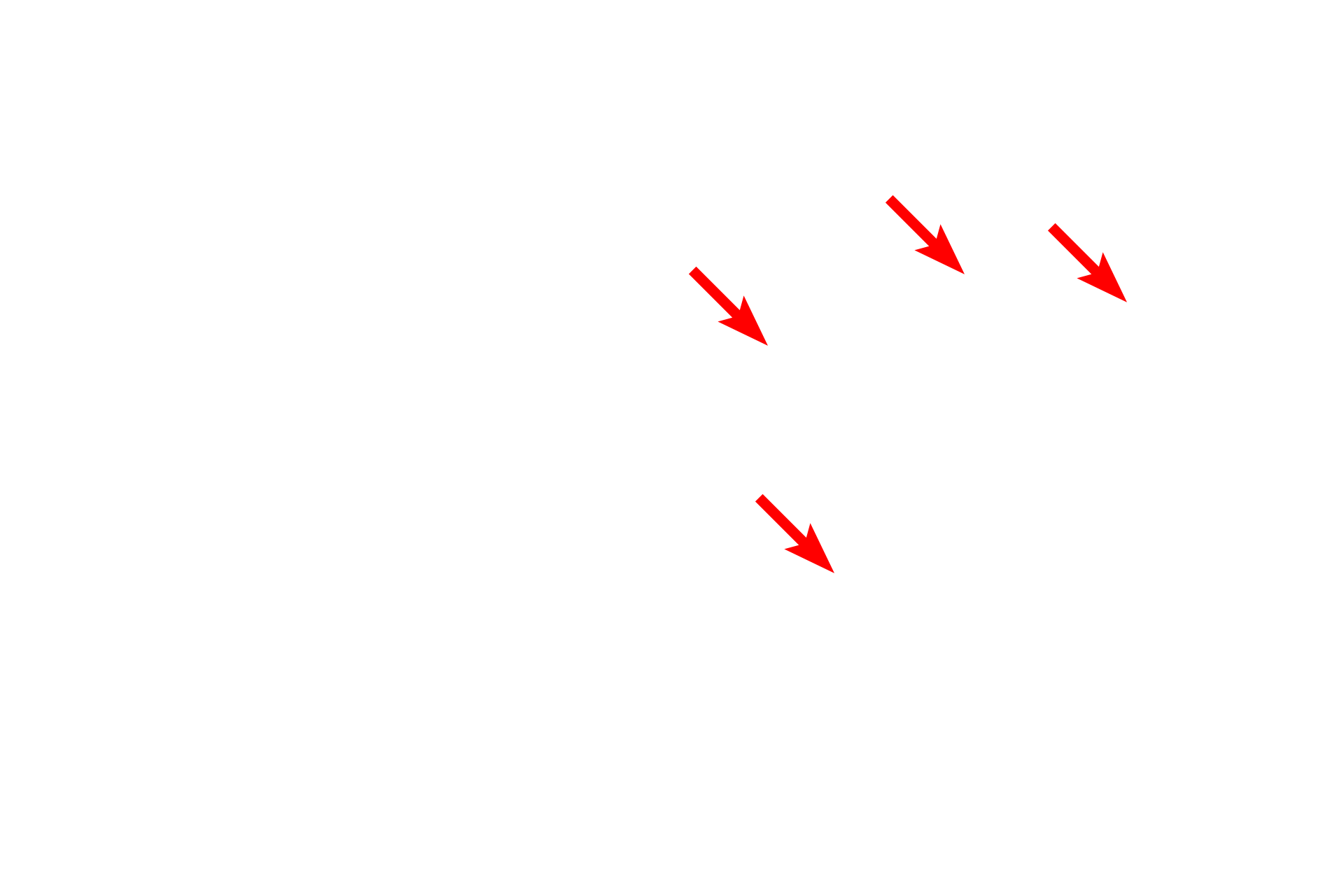  - Cytoplasmic granules  <p>This electron micrograph reveals the neutrophil granules. There are two types of granules, azurophilic (primary) granules that contain myeloperoxidase and specific (secondary) granules that are more numerous and contain a variety of antimicrobial enzymes. It is often difficult to distinguish the granule types without special histochemical stains.</p>
