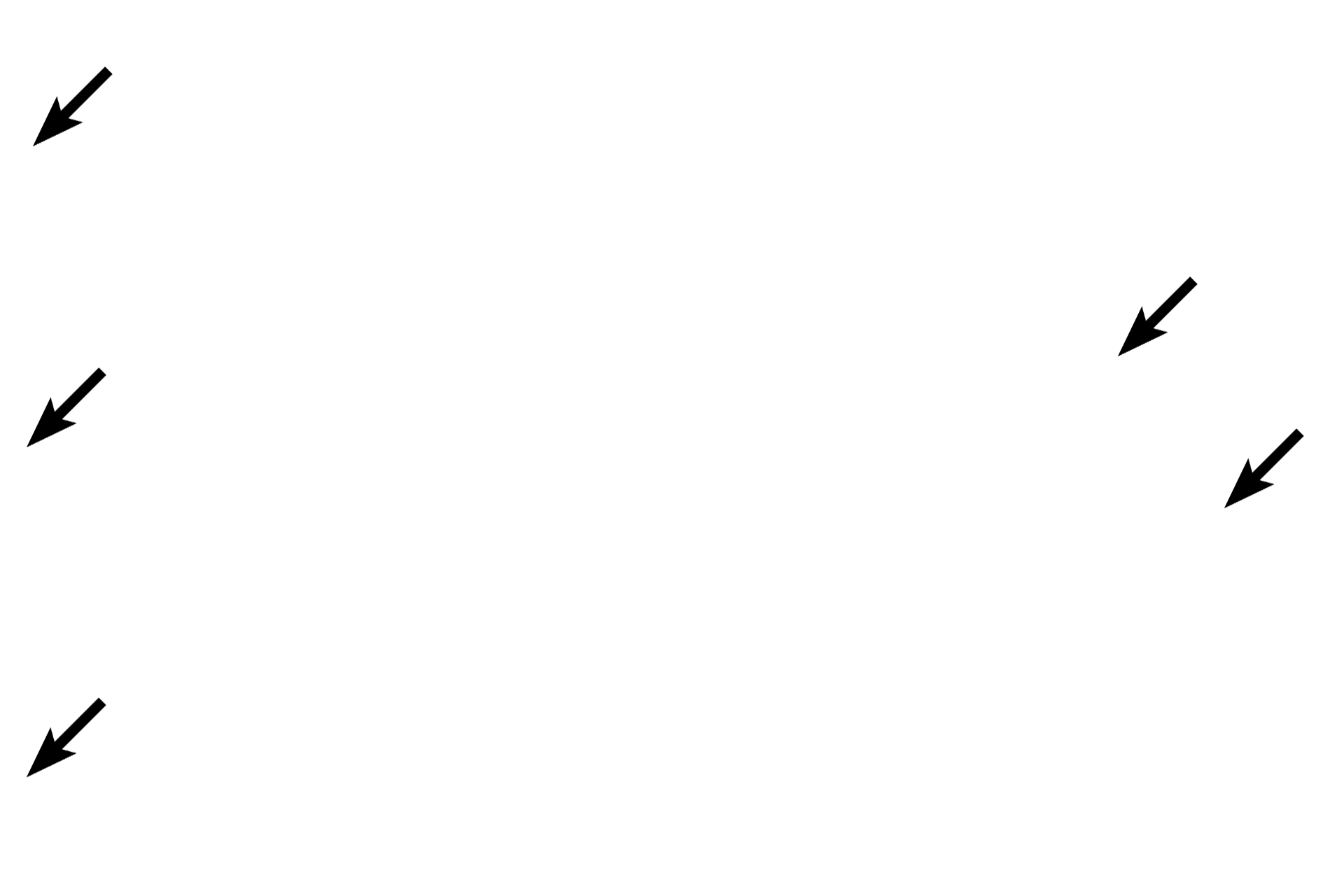 Dense irregular connective tissue <p>Dense regular connective tissue forms tendons (seen here) and ligaments.  These structures are composed of densely packed collagen bundles in parallel array.  Aligned between the bundles are flattened, heterochromatic nuclei of fibroblasts.  This construction ideally resists tension and maximally transmits force.  Tendons connect muscle with bone; ligaments connect bone with bone.  400x, 400x</p>

