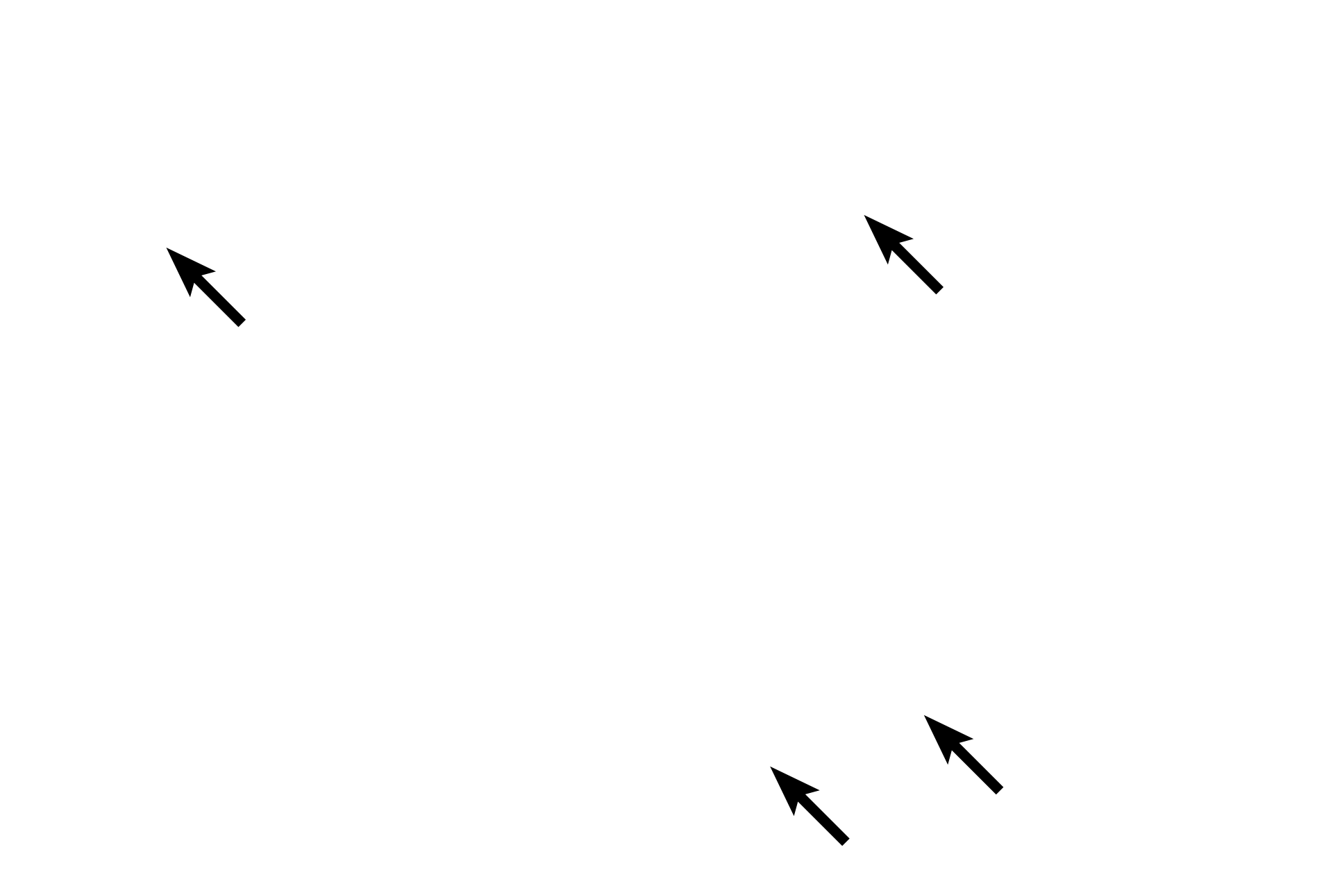 Fibroblast cytoplasm <p>This higher magnification of a tendon shows the regular, compact nature of dense regular connective tissue. The fibroblasts, also referred to as tendinocytes in tendons, are highly flattened and aligned with collagen bundles. They have heterochromatic nuclei and minimal cytoplasm. 1000x</p>
