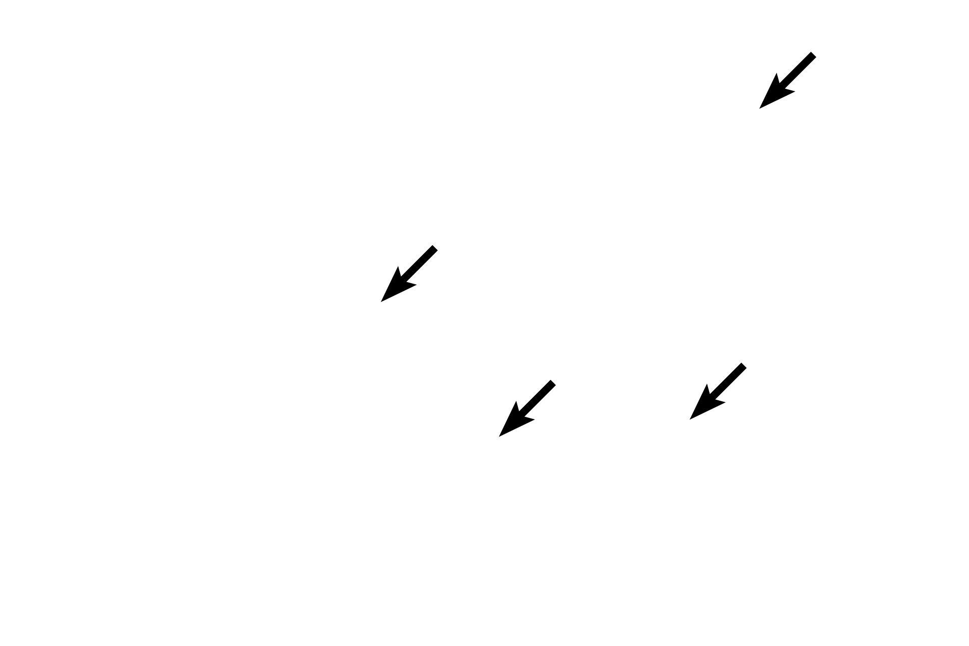 Collagen fibers <p>Loose connective tissue consists of a variety of numerous cells, abundant, gelatinous ground substance, and small caliber collagen fibers mixed with elastic and reticular fibers.  Elastic and reticular fibers are better distinguished with special stains.  The nuclei of active and inactive fibroblasts, adipose cells and macrophages are visible in this image.  400x</p>
