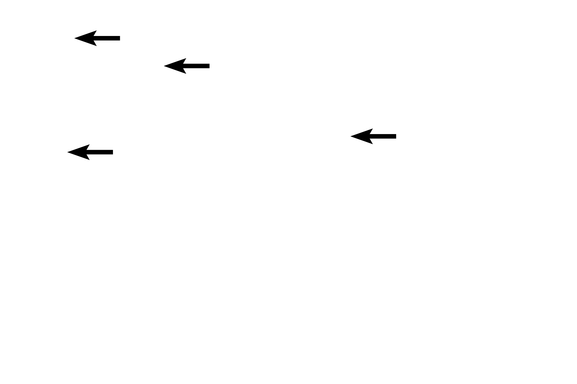 Active fibroblast nuclei <p>Loose connective tissue consists of a variety of numerous cells, abundant, gelatinous ground substance, and small caliber collagen fibers mixed with elastic and reticular fibers.  Elastic and reticular fibers are better distinguished with special stains.  The nuclei of active and inactive fibroblasts, adipose cells and macrophages are visible in this image.  400x</p>
