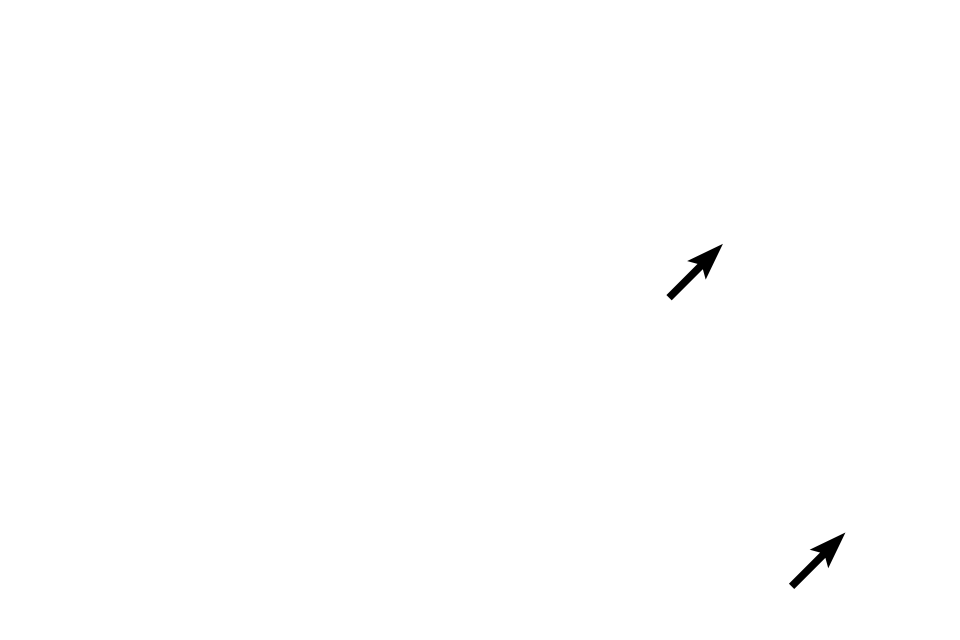 Inactive fibroblast nuclei <p>Loose connective tissue consists of a variety of numerous cells, abundant, gelatinous ground substance, and small caliber collagen fibers mixed with elastic and reticular fibers.  Elastic and reticular fibers are better distinguished with special stains.  The nuclei of active and inactive fibroblasts, adipose cells and macrophages are visible in this image.  400x</p>
