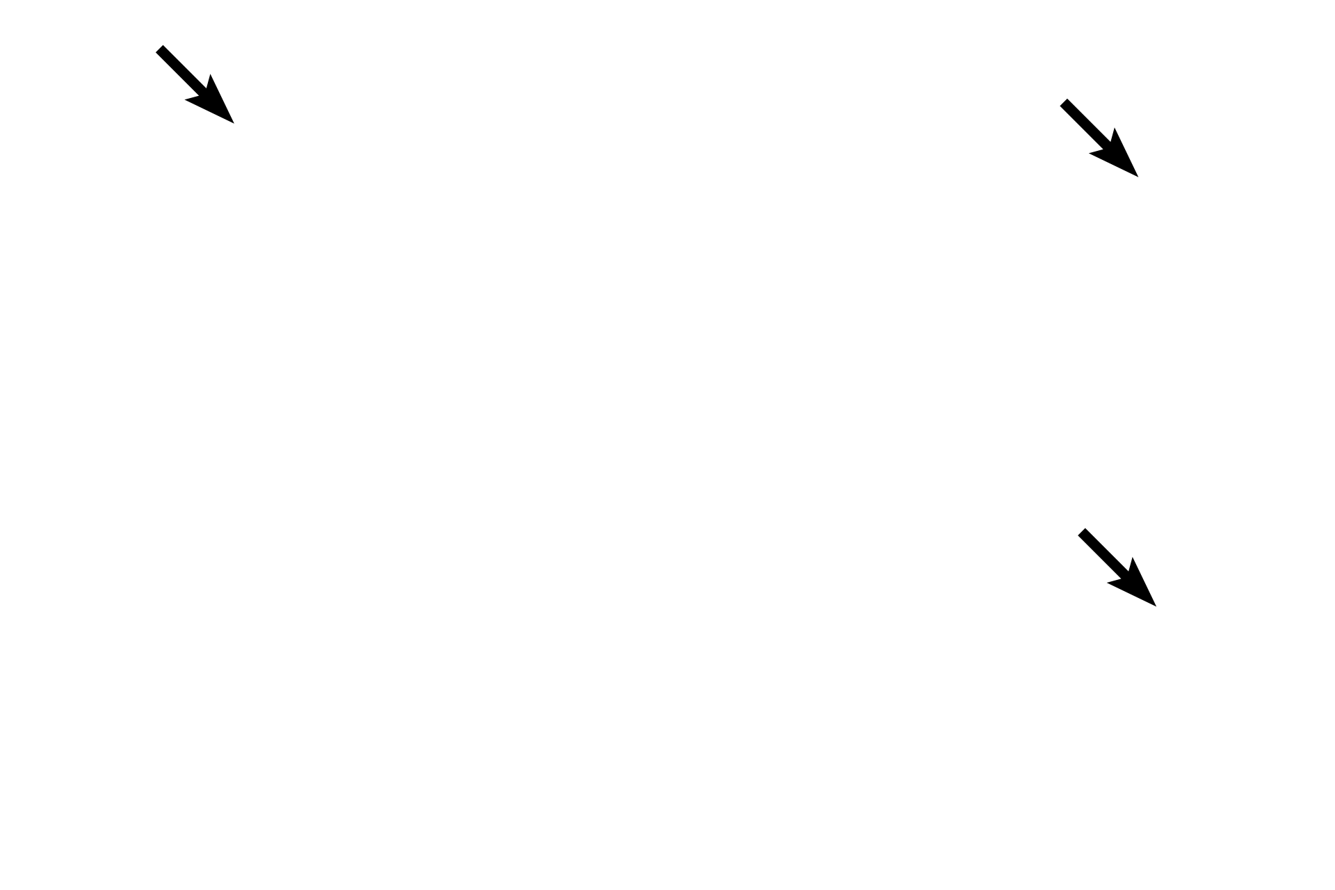 Macrophages <p>Loose connective tissue consists of a variety of numerous cells, abundant, gelatinous ground substance, and small caliber collagen fibers mixed with elastic and reticular fibers.  Elastic and reticular fibers are better distinguished with special stains.  The nuclei of active and inactive fibroblasts, adipose cells and macrophages are visible in this image.  400x</p>
