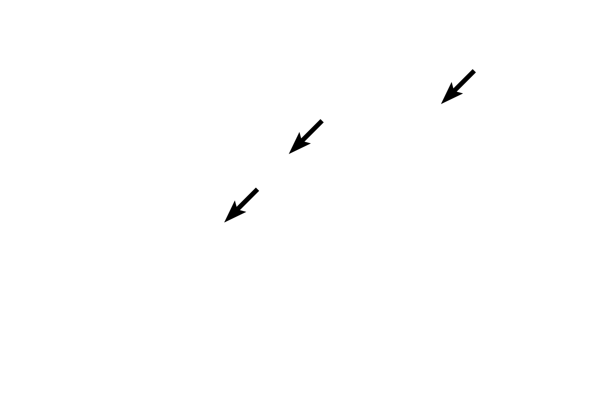 Blood vessels <p>Loose connective tissue consists of a variety of numerous cells, abundant, gelatinous ground substance, and small caliber collagen fibers mixed with elastic and reticular fibers.  Elastic and reticular fibers are better distinguished with special stains.  The nuclei of active and inactive fibroblasts, adipose cells and macrophages are visible in this image.  400x</p>
