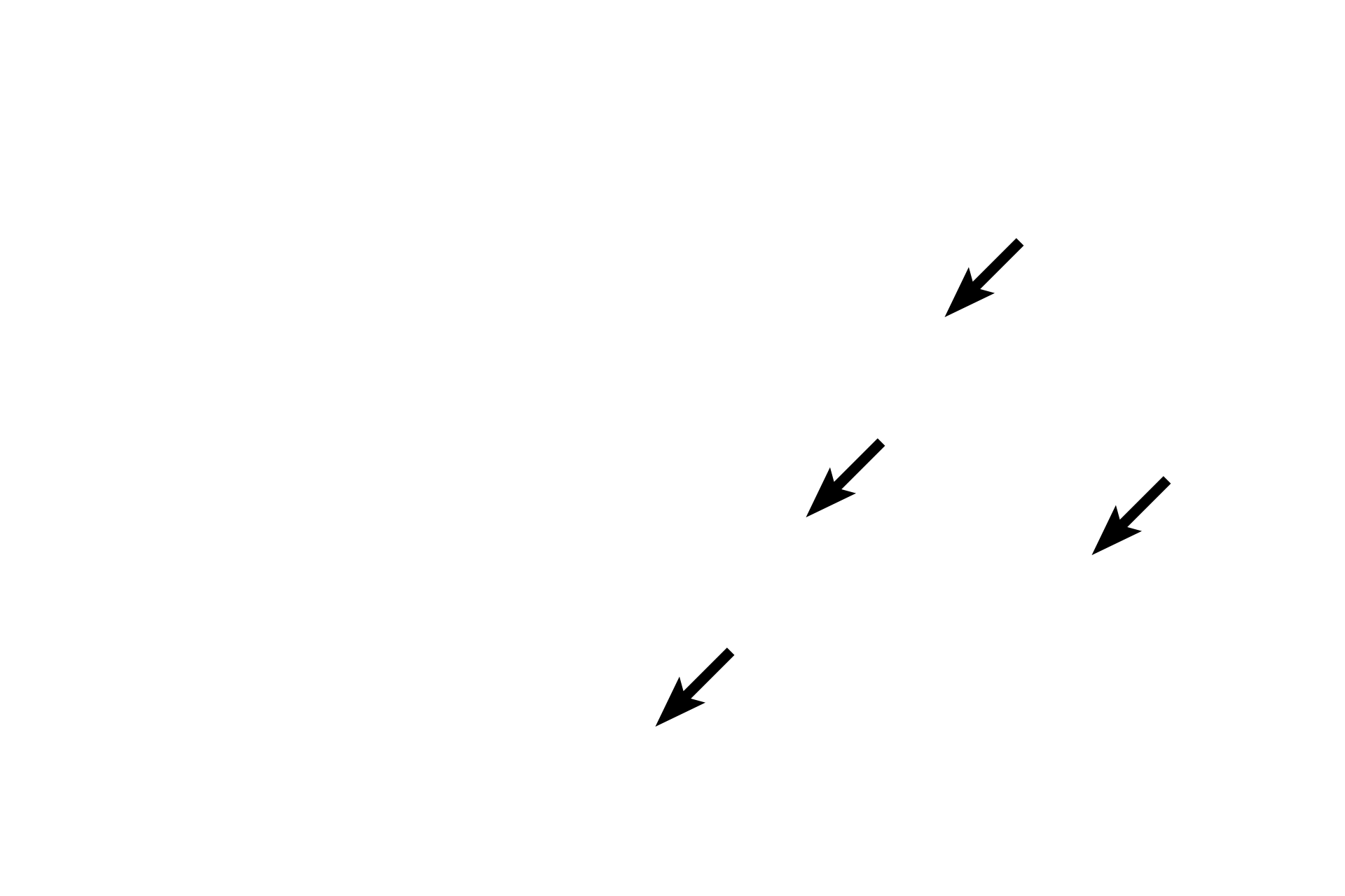 Capillaries <p>This loose connective tissue demonstrates its abundant, gelatinous ground substance in which are located numerous nuclei (mostly fibroblasts), capillaries, and the cobweb-like arrangement of collagen and elastic fibers.  100x</p>
