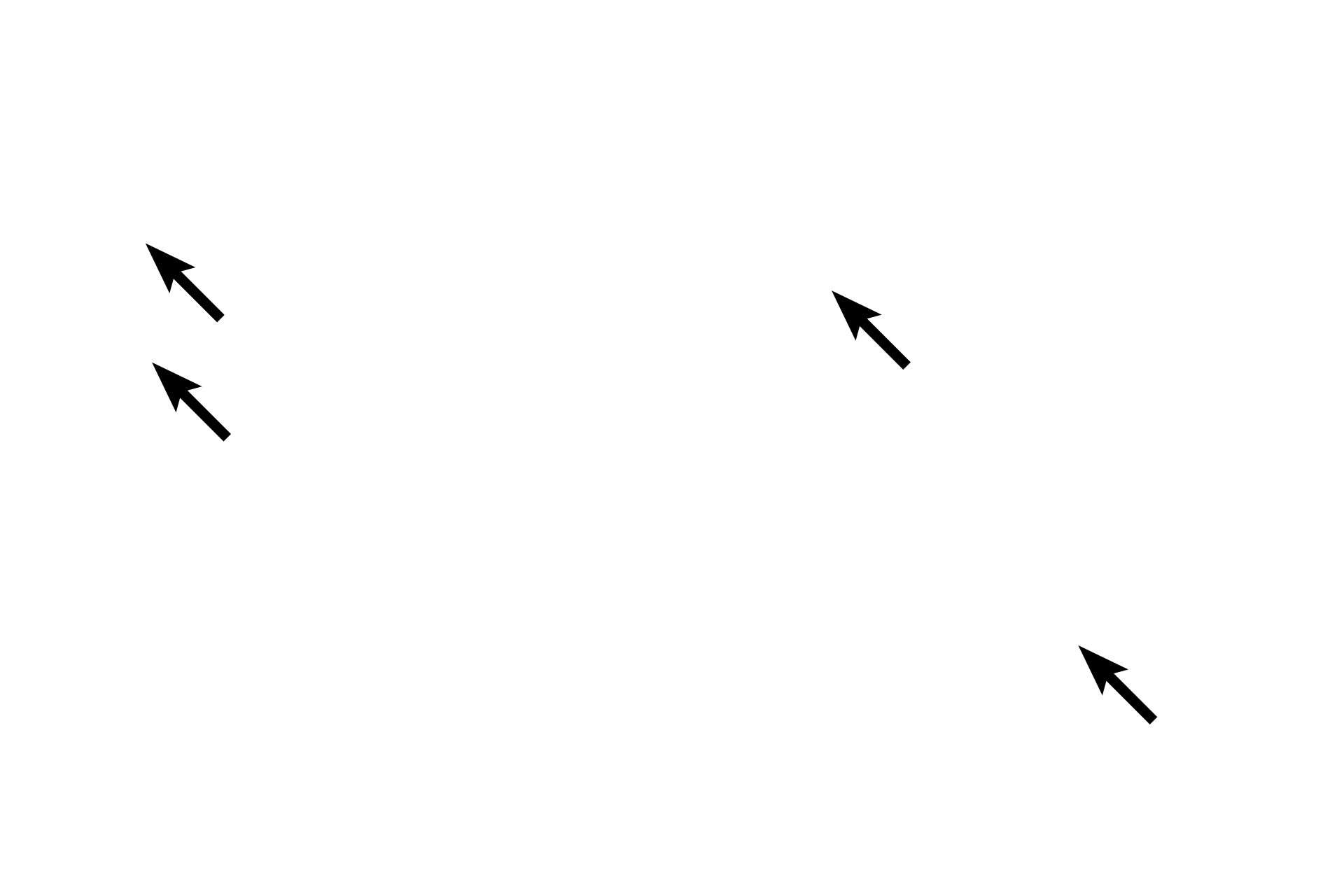 Mast cells <p>This loose connective tissue demonstrates its abundant, gelatinous ground substance in which are located numerous nuclei (mostly fibroblasts), capillaries, and the cobweb-like arrangement of collagen and elastic fibers.  100x</p>
