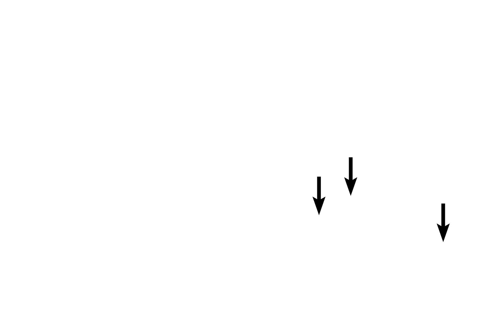 Adipocytes <p>In loose connective tissue, the collagen fibers are thin, delicate and have no organized arrangement, thus giving this tissue the classification “loose.”  In addition, loose connective tissue is highly cellular and the population of cells is diverse.  This image also shows an adjacent region of dense irregular connective tissue for comparison.  400x</p>
