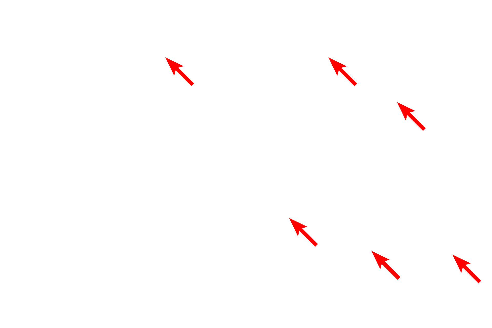 Elastic fibers <p>The dermis of the skin is composed of loose connective tissue interfacing with an underlying dense irregular connective tissue.  The loose connective tissue is more cellular, with smaller caliber collagen and elastic fibers than the coarser, dense irregular connective tissue.  This toluidine blue-stained section shows the elastic fibers to advantage.  1000x</p>
