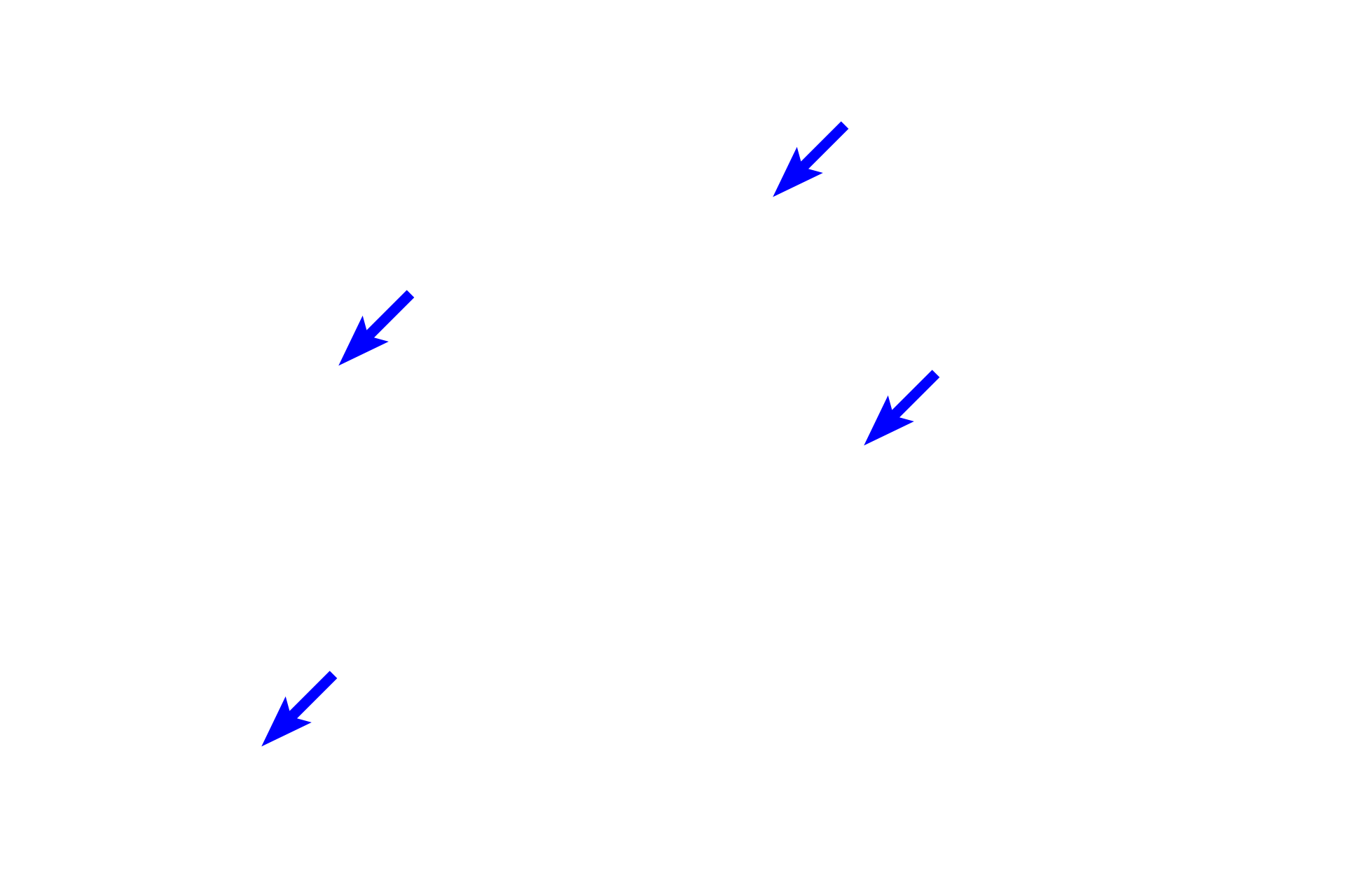 Collagen fibers <p>The structure of connective tissue proper varies according to the needs of the tissue. Loose connective tissue allows for diffusion of nutrients and migration of immune cells as wells as providing delicate padding beneath epithelia and around glands and vessels. Dense connective tissue is found where greater strength or support is needed, such as the deep layers of the skin and walls of organs. It also forms tendons and ligaments. Skin 400x</p>
