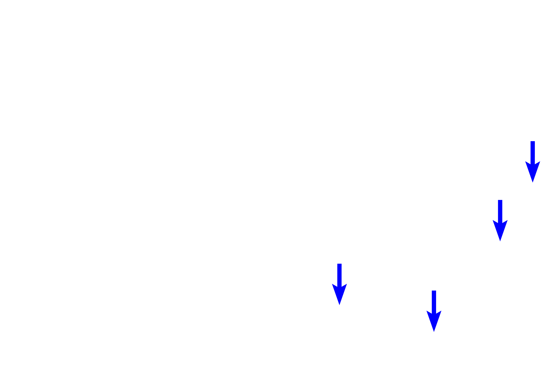 Collagen bundles <p>The structure of connective tissue proper varies according to the needs of the tissue. Loose connective tissue allows for diffusion of nutrients and migration of immune cells as wells as providing delicate padding beneath epithelia and around glands and vessels. Dense connective tissue is found where greater strength or support is needed, such as the deep layers of the skin and walls of organs. It also forms tendons and ligaments. Skin 400x</p>
