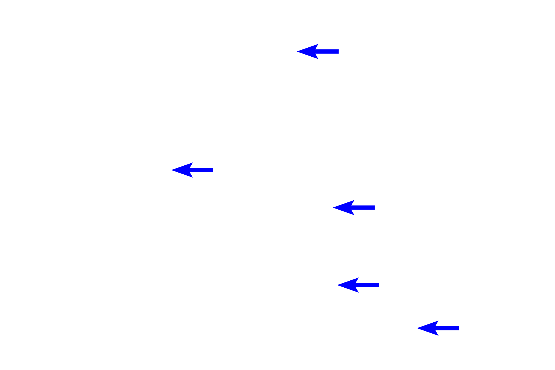 Connective tissue cells <p>The structure of connective tissue proper varies according to the needs of the tissue. Loose connective tissue allows for diffusion of nutrients and migration of immune cells as wells as providing delicate padding beneath epithelia and around glands and vessels. Dense connective tissue is found where greater strength or support is needed, such as the deep layers of the skin and walls of organs. It also forms tendons and ligaments. Skin 400x</p>
