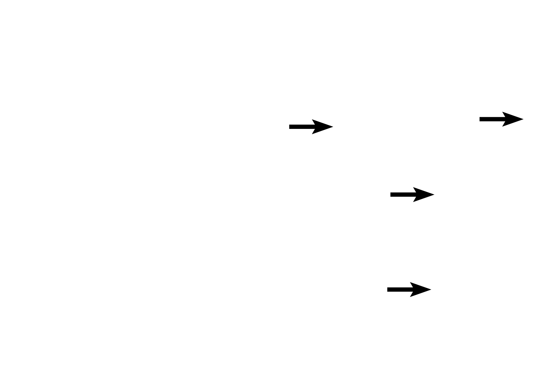 Collagen bundles <p>Collagen fibers, the most abundant of the connective tissue fibers, are produced by fibroblasts and stain pink with eosin. These fibers are flexible, but do not stretch and, thus, provide great tensile strength to the tissue. Smaller fibers may aggregate to form larger collagen bundles, and fiber size and orientation are used for classifying connective tissue proper.</p>

