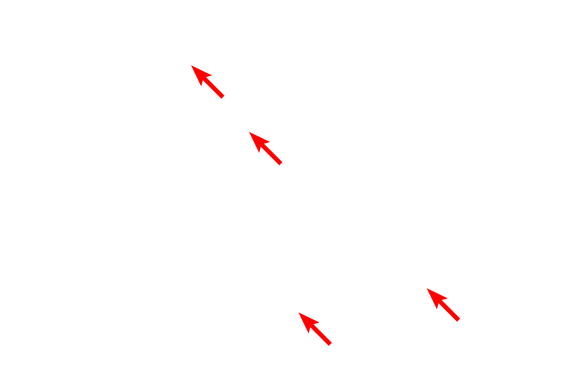 Elastic fibers <p>Toluidine blue staining differentiates elastic and collagen fibers more dramatically than eosin.  Elastic fibers stain dark blue, while collagen fibers are light blue.  Note that smaller elastic fibers predominate in the upper region which is composed of loose connective tissue.  Larger caliber fibers, both elastic and collagen, predominate in the dense connective tissue at the bottom.  The elastic fibers present in both regions give the skin its distensibility while the collagen fibers provide tensile strength. Skin 1000x</p>
