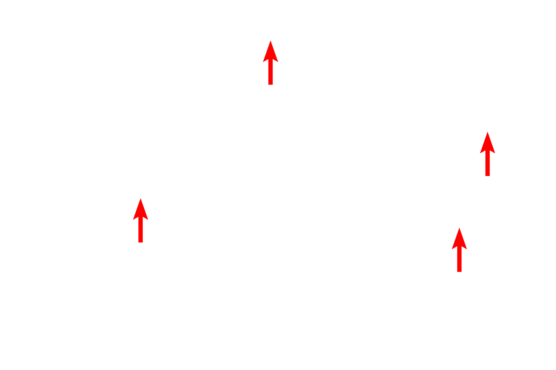 Collagen fibers <p>Toluidine blue staining differentiates elastic and collagen fibers more dramatically than eosin.  Elastic fibers stain dark blue, while collagen fibers are light blue.  Note that smaller elastic fibers predominate in the upper region which is composed of loose connective tissue.  Larger caliber fibers, both elastic and collagen, predominate in the dense connective tissue at the bottom.  The elastic fibers present in both regions give the skin its distensibility while the collagen fibers provide tensile strength. Skin 1000x</p>
