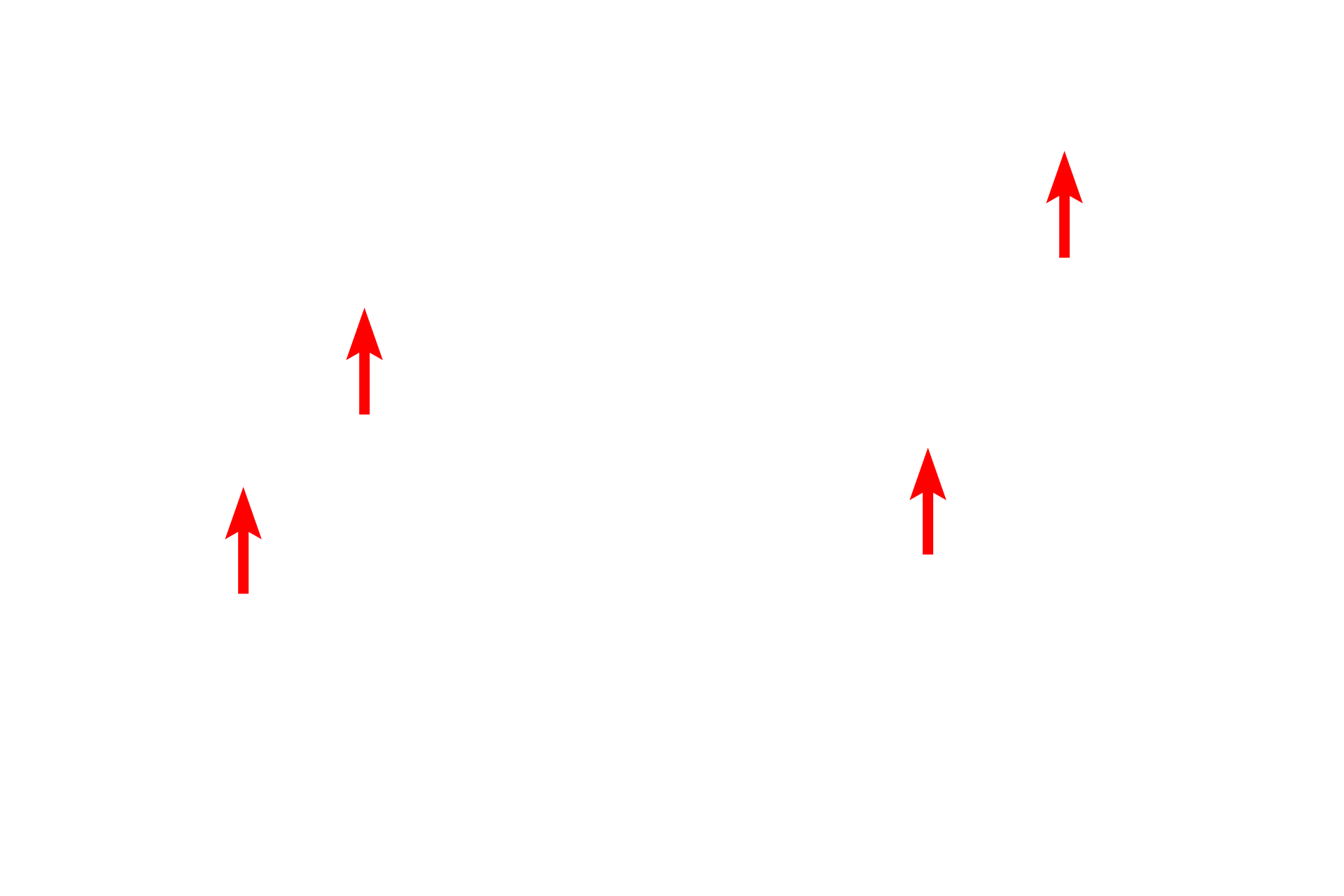 Elastic fibers <p>Elastic and collagen fibers are shown in this electron micrograph of dense irregular connective tissue. Both fiber types are produced by fibroblasts. Elastic fibers, which appear amorphous and more darkly stained than collagen fibers, consist of a dense core of elastin protein surrounded by a network of microfibrils. Collagen fibers consist of bundles of individual collagen fibrils. 5000x</p>
