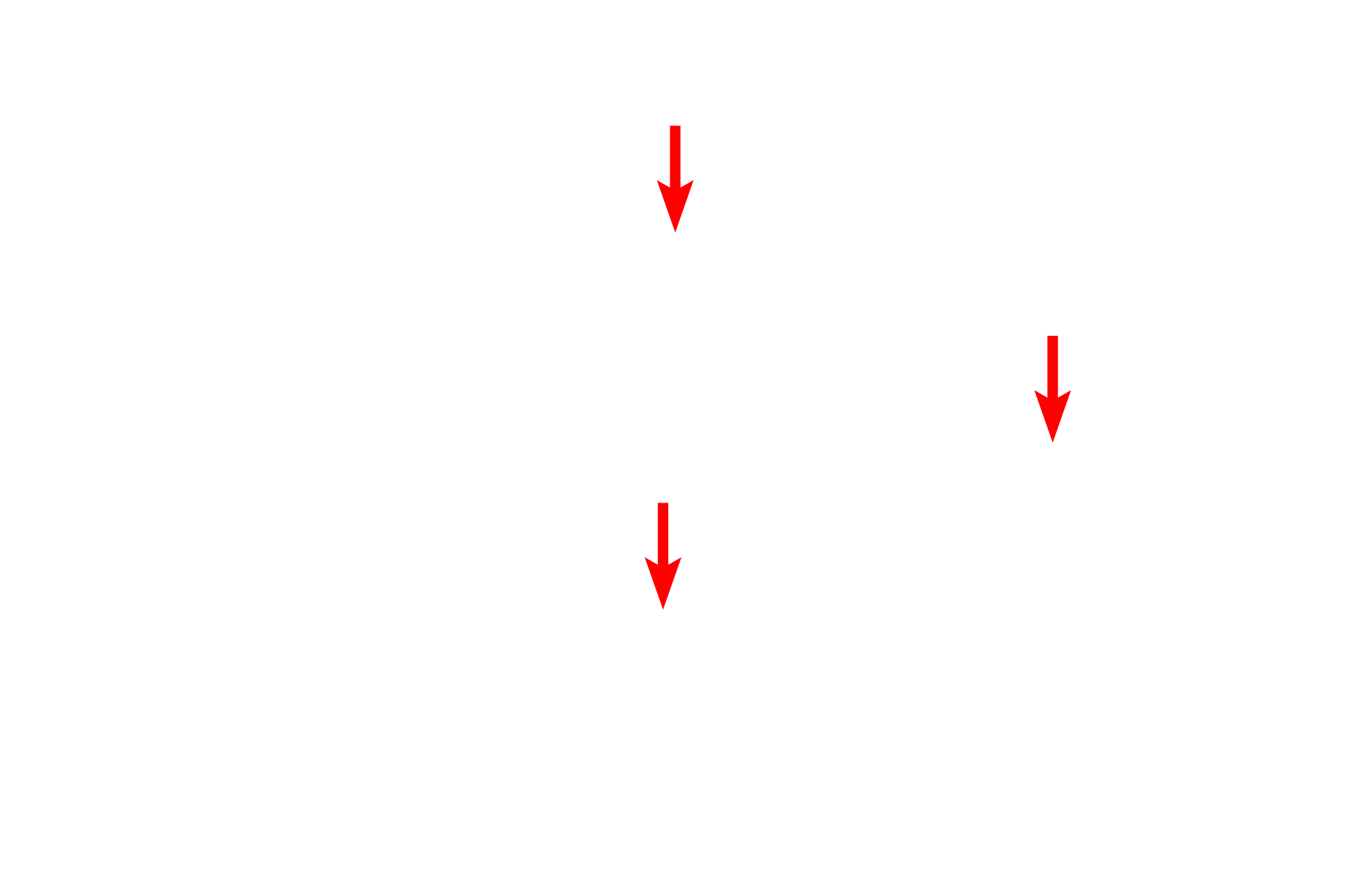 Collagen fibrils <p>Elastic and collagen fibers are shown in this electron micrograph of dense irregular connective tissue. Both fiber types are produced by fibroblasts. Elastic fibers, which appear amorphous and more darkly stained than collagen fibers, consist of a dense core of elastin protein surrounded by a network of microfibrils. Collagen fibers consist of bundles of individual collagen fibrils. 5000x</p>
