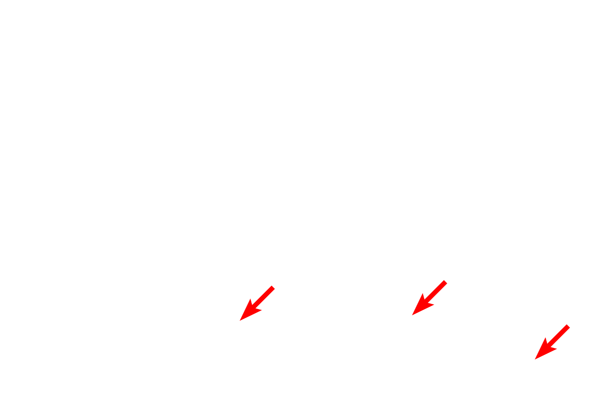 Fibroblast <p>Elastic and collagen fibers are shown in this electron micrograph of dense irregular connective tissue. Both fiber types are produced by fibroblasts. Elastic fibers, which appear amorphous and more darkly stained than collagen fibers, consist of a dense core of elastin protein surrounded by a network of microfibrils. Collagen fibers consist of bundles of individual collagen fibrils. 5000x</p>
