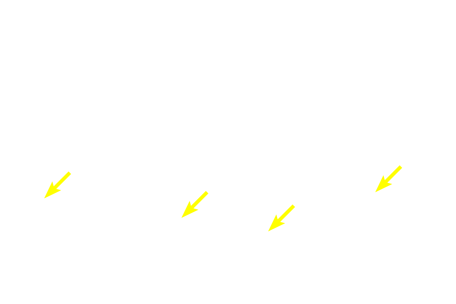 Elastic fibers <p>A large accumulation of elastic fibers forms an elastic membrane in the connective tissue beneath the epithelium of the trachea.  In this section, the elastic fibers are cut in cross section. 400x</p>
