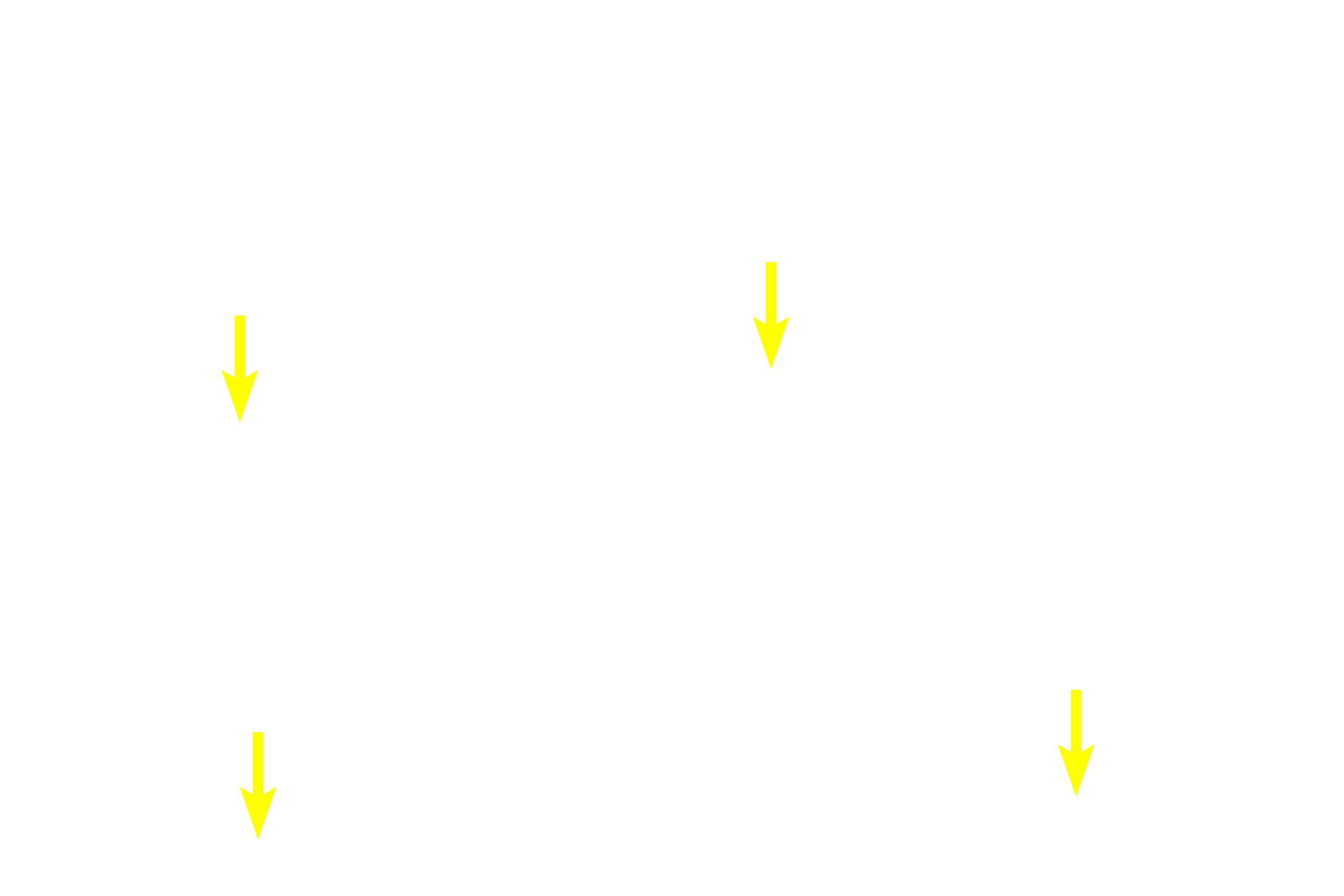 Collagen fibers <p>A large accumulation of elastic fibers forms an elastic membrane in the connective tissue beneath the epithelium of the trachea.  In this section, the elastic fibers are cut in cross section. 400x</p>
