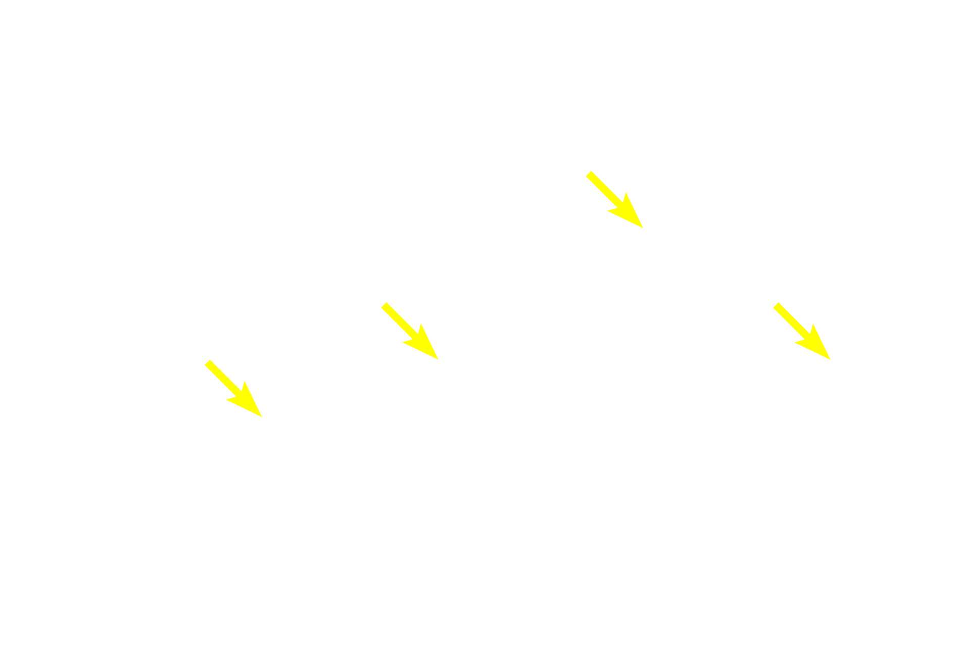 Fibroblasts <p>A large accumulation of elastic fibers forms an elastic membrane in the connective tissue beneath the epithelium of the trachea.  In this section, the elastic fibers are cut in cross section. 400x</p>
