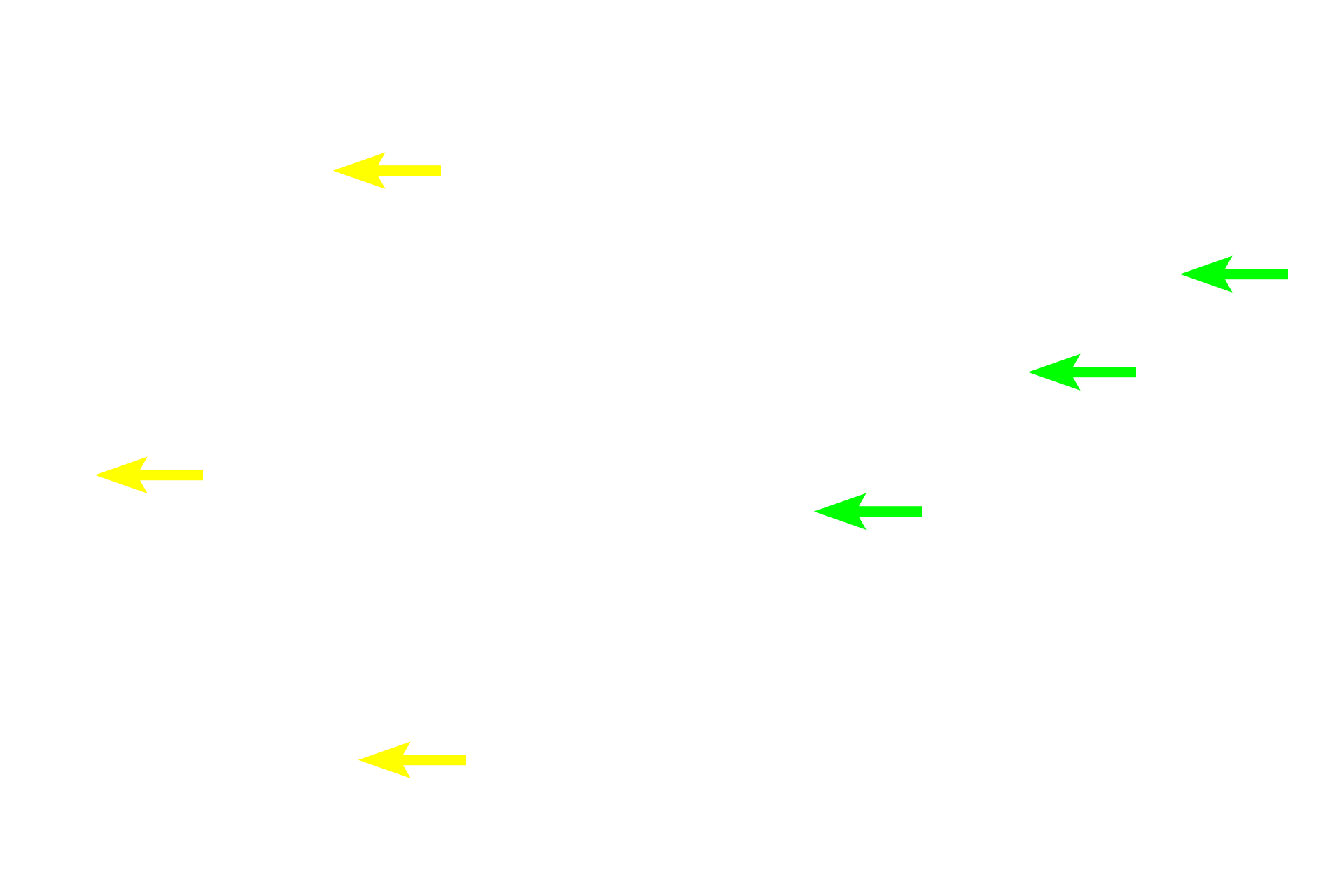 Elastic laminae <p>Sometimes the major component of elastic fibers, elastin, forms sheets, termed elastic laminae, rather than fibers. Elastic laminae are fenestrated, i.e., they have holes in them, like slices of Swiss cheese. Between the laminae are smooth muscle cells that produce the laminae. Cross sections of elastic arteries: left image, hematoxylin and eosin; right image, elastin stain.  800x, 800x </p>
