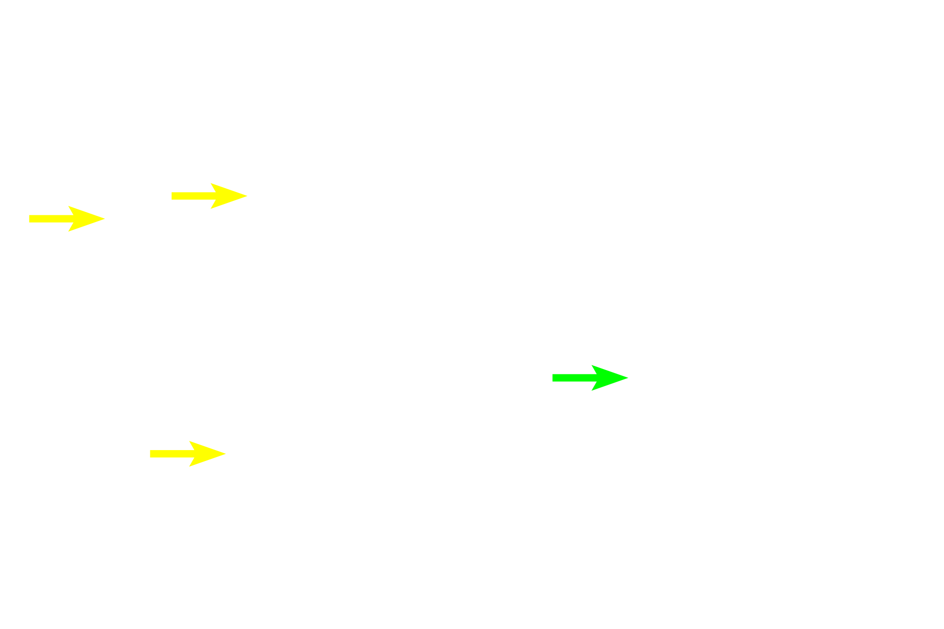 Fenestrations <p>Sometimes the major component of elastic fibers, elastin, forms sheets, termed elastic laminae, rather than fibers. Elastic laminae are fenestrated, i.e., they have holes in them, like slices of Swiss cheese. Between the laminae are smooth muscle cells that produce the laminae. Cross sections of elastic arteries: left image, hematoxylin and eosin; right image, elastin stain.  800x, 800x </p>
