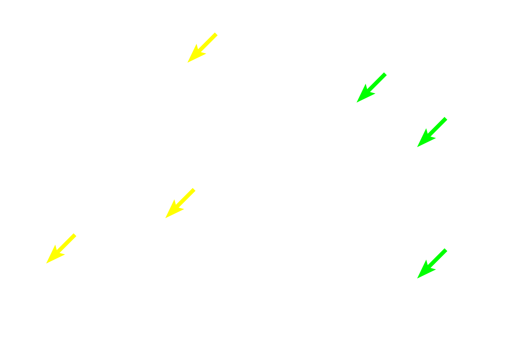 Smooth muscle cells <p>Sometimes the major component of elastic fibers, elastin, forms sheets, termed elastic laminae, rather than fibers. Elastic laminae are fenestrated, i.e., they have holes in them, like slices of Swiss cheese. Between the laminae are smooth muscle cells that produce the laminae. Cross sections of elastic arteries: left image, hematoxylin and eosin; right image, elastin stain.  800x, 800x </p>
