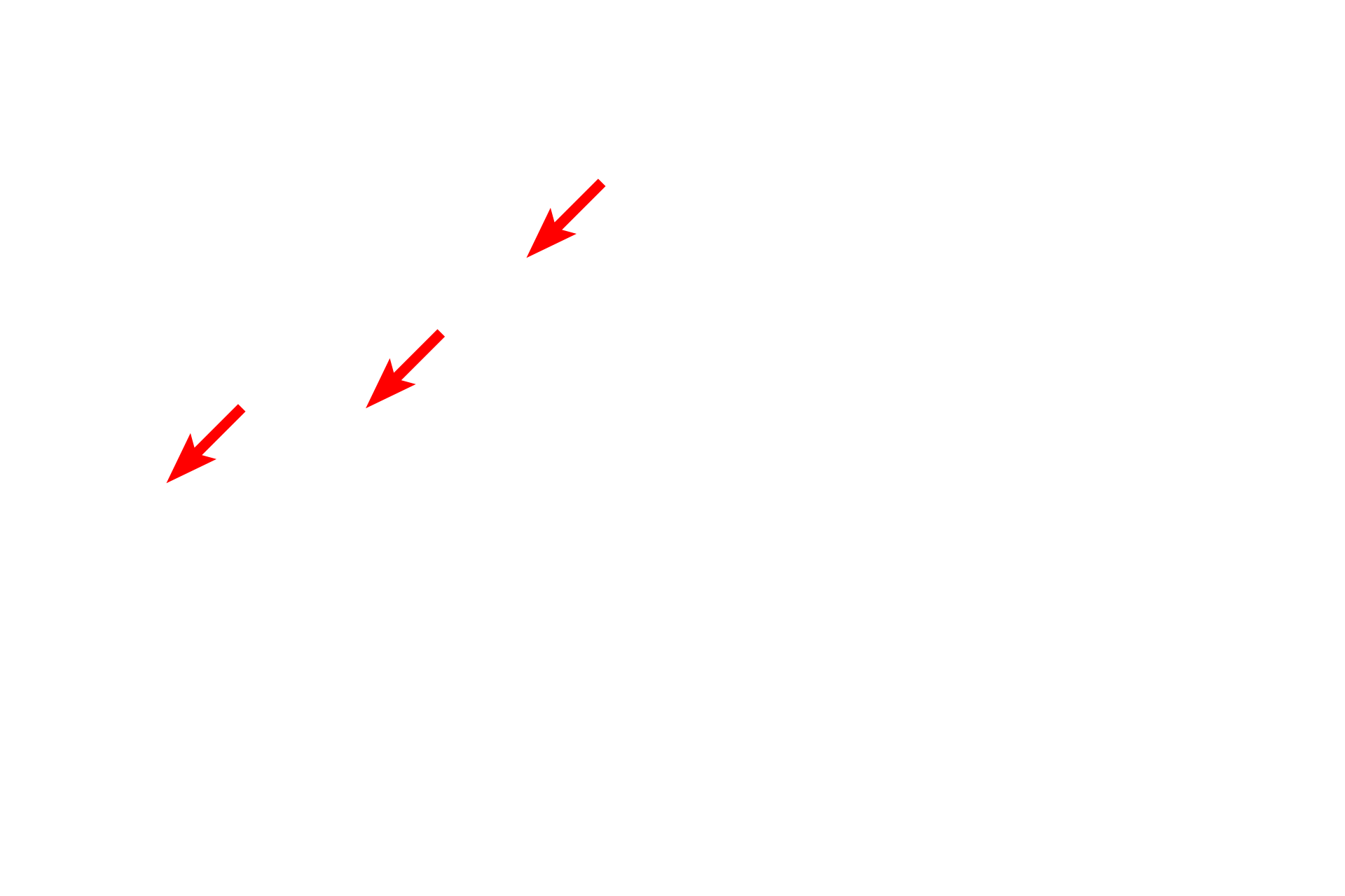 Basal lamina <p>This electron micrograph shows the loose connective tissue that lies beneath all epithelia. Individual collagen fibrils are visible in both longitudinal and cross section. Note the regular banding in the longitudinally oriented fibrils. In other areas, these fibrils can aggregate to form larger fibers and bundles. 25,000x</p>
