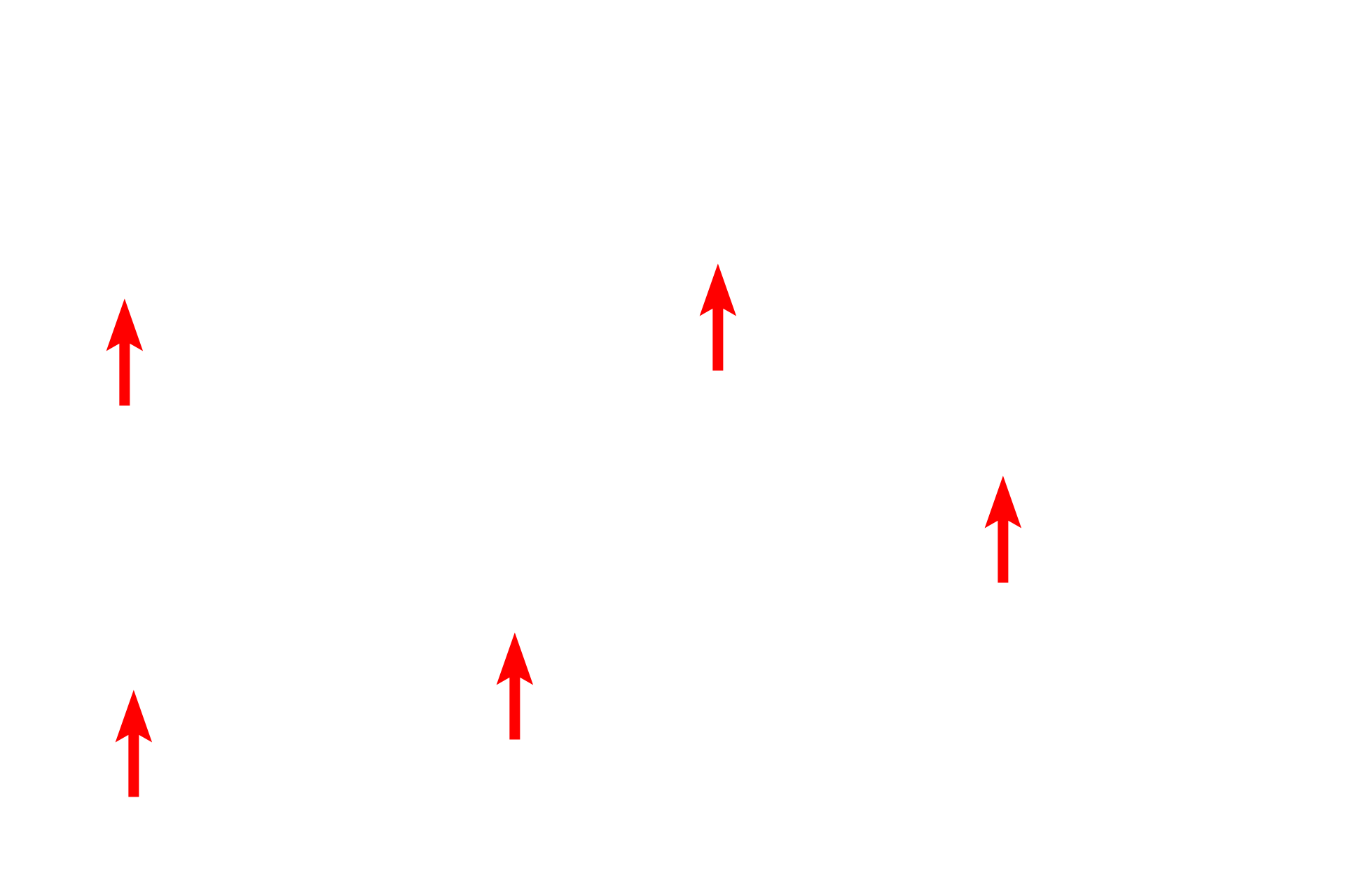 Collagen fibrils <p>Fibroblasts secrete tropocollagen molecules that assemble into collagen fibrils, displaying a repeating 64 nm banding pattern.  There are numerous types of collagen, the most prevalent being Types I, II, III and IV.  Types I, II and III form fibrils; Type IV, a major component of the basal lamina, does not. Type I fibrils further assemble into larger fibers and bundles, which can range from 1 to 20 microns in diameter.  A small peripheral nerve is seen surrounded by a large fiber.  14,000x </p>
