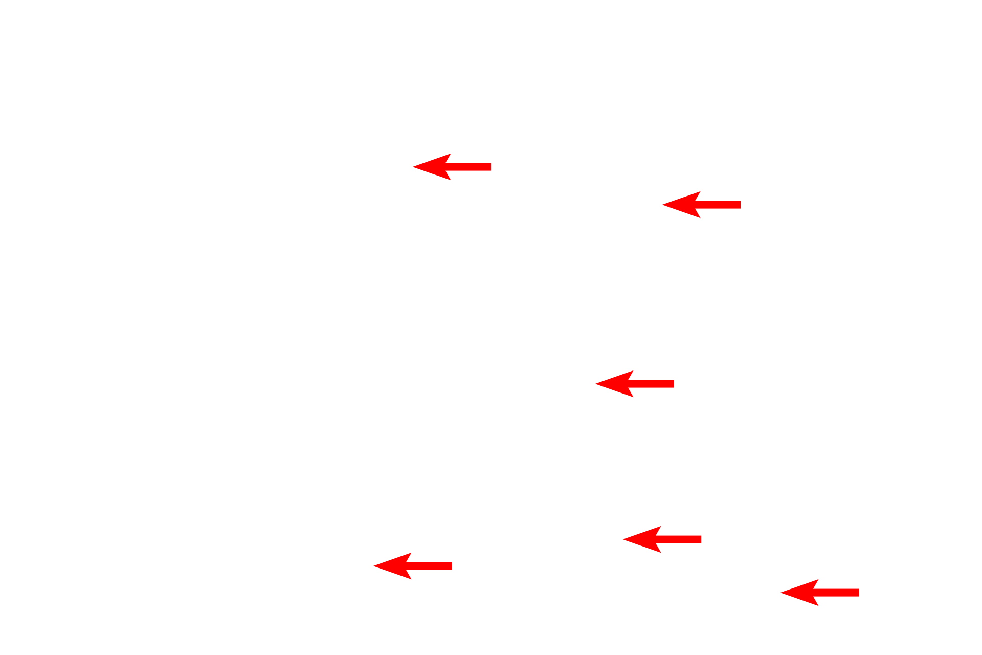 Collagen fibers <p>This electron micrograph of dense connective tissue shows tightly packed, Type I collagen fibers with interspersed fibroblasts and their processes. 10,000x</p>
