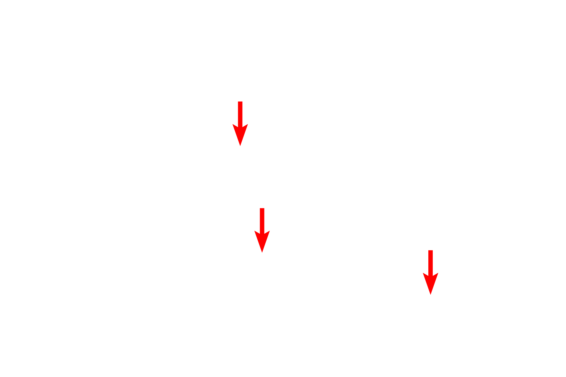 Branch points <p>Reticular fibers are a component of all connective tissues proper and provide the sole stroma for lymphatic organs (except thymus) and hemopoietic tissue. Reticular fibers also surround adipocytes, small blood vessels and nerves, and muscle fibers. This high magnification image illustrates the characteristic branching meshwork of reticular fibers. Lymph node 1000x</p>
