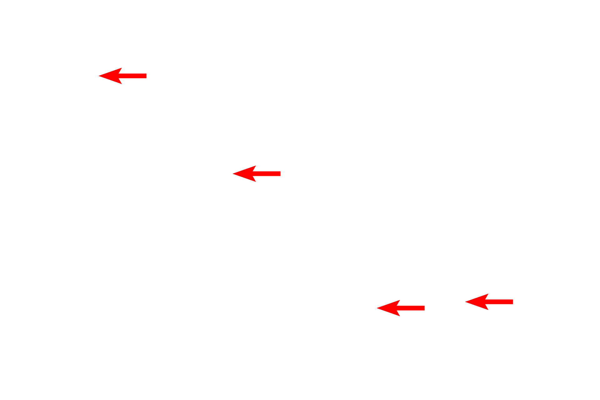 Elastic fibers <p>A higher magnification of Movat pentachrome-stained skin shows the interlacing nature of the collagen and elastic fibers. This arrangement of fibers provides the skin with mechanical support and strength (collagen fibers) and elasticity (elastic fibers).  1000x</p>
