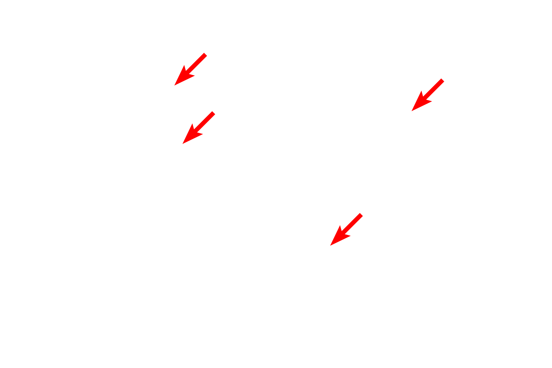 Collagen fibers <p>A higher magnification of Movat pentachrome-stained skin shows the interlacing nature of the collagen and elastic fibers. This arrangement of fibers provides the skin with mechanical support and strength (collagen fibers) and elasticity (elastic fibers).  1000x</p>
