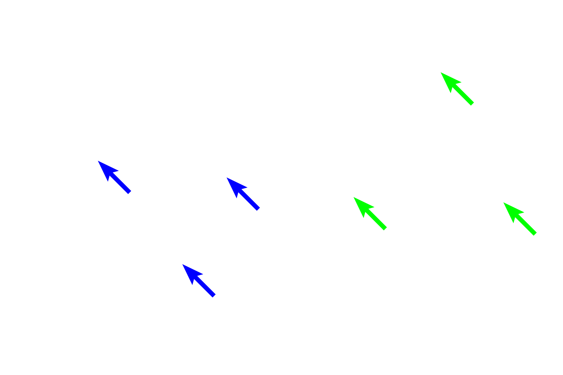 Elastic fibers <p>These images of dense irregular connective tissue in the skin compare the appearance of elastic fibers stained with hematoxylin and eosin with that using a special elastin stain. Elastic fibers are eosinophilic and in some sections, as shown here, can be distinguished from collagen fibers with eosin alone. In most cases however, a special elastin stain, the Verhoeff method, is required and is shown in the right panel.  The Verhoeff method stains elastic fibers black and collagen fibers red.  400x, 400x</p>
