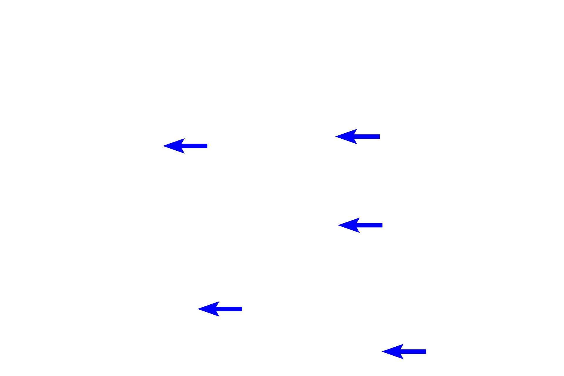 Adipocyte nuclei <p>White adipose connective tissue is composed of lobules of adipocytes separated by prominent connective tissue septa containing blood and lymphatic vessels. Individual adipocytes contain a single, large lipid droplet (lost during tissue processing), a crescent-shaped nucleus and cytoplasm that is flattened to the periphery of the droplet. Hypodermis 100x</p>
