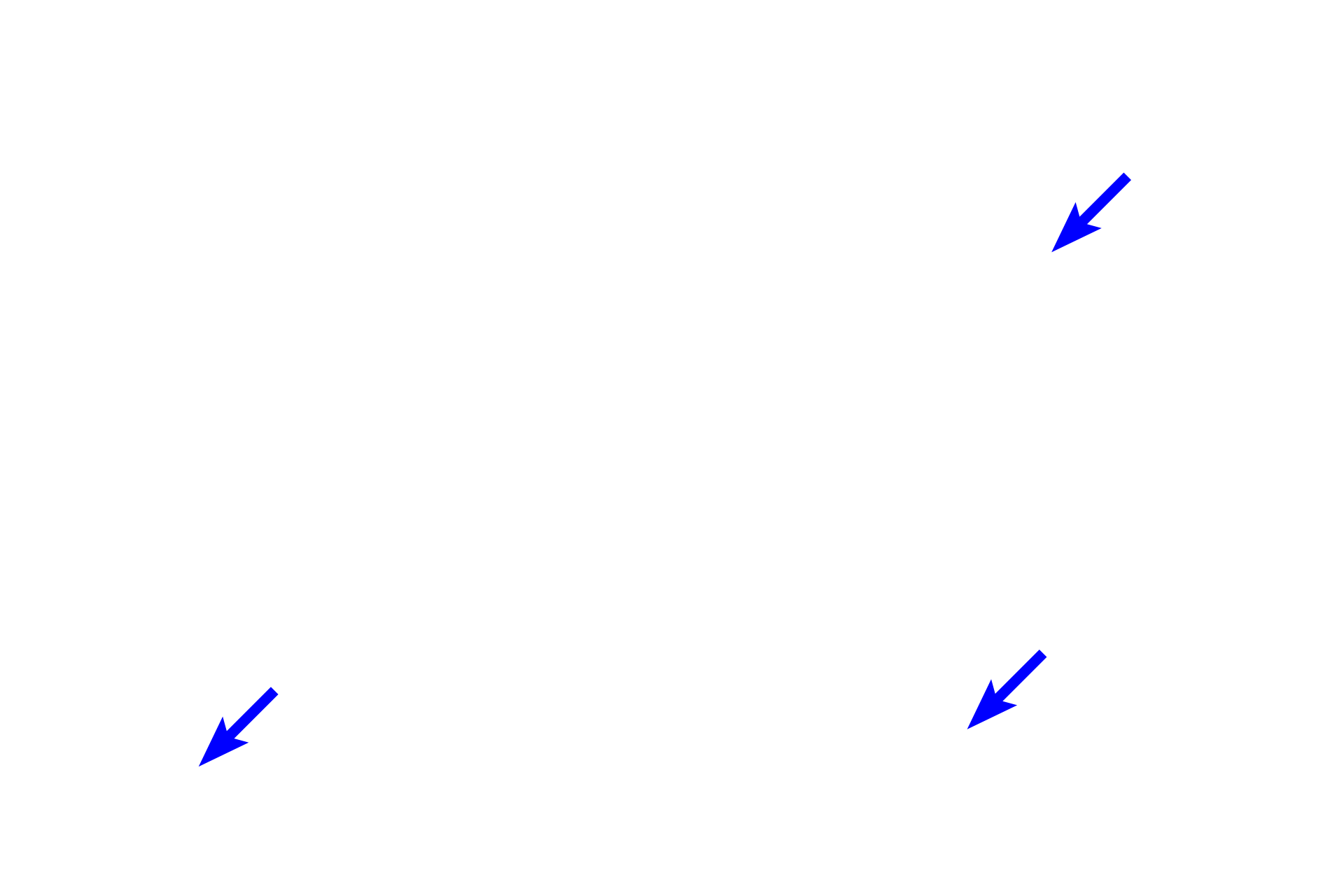 Blood vessels <p>A collection of adipocytes in subcutaneous tissue beneath the skin demonstrates the empty-appearing cells resulting from the loss of lipid during tissue processing. In addition to lipid storage, white adipose connective tissue in this location also serves a thermal insulating function. Hypodermis 1000x</p>
