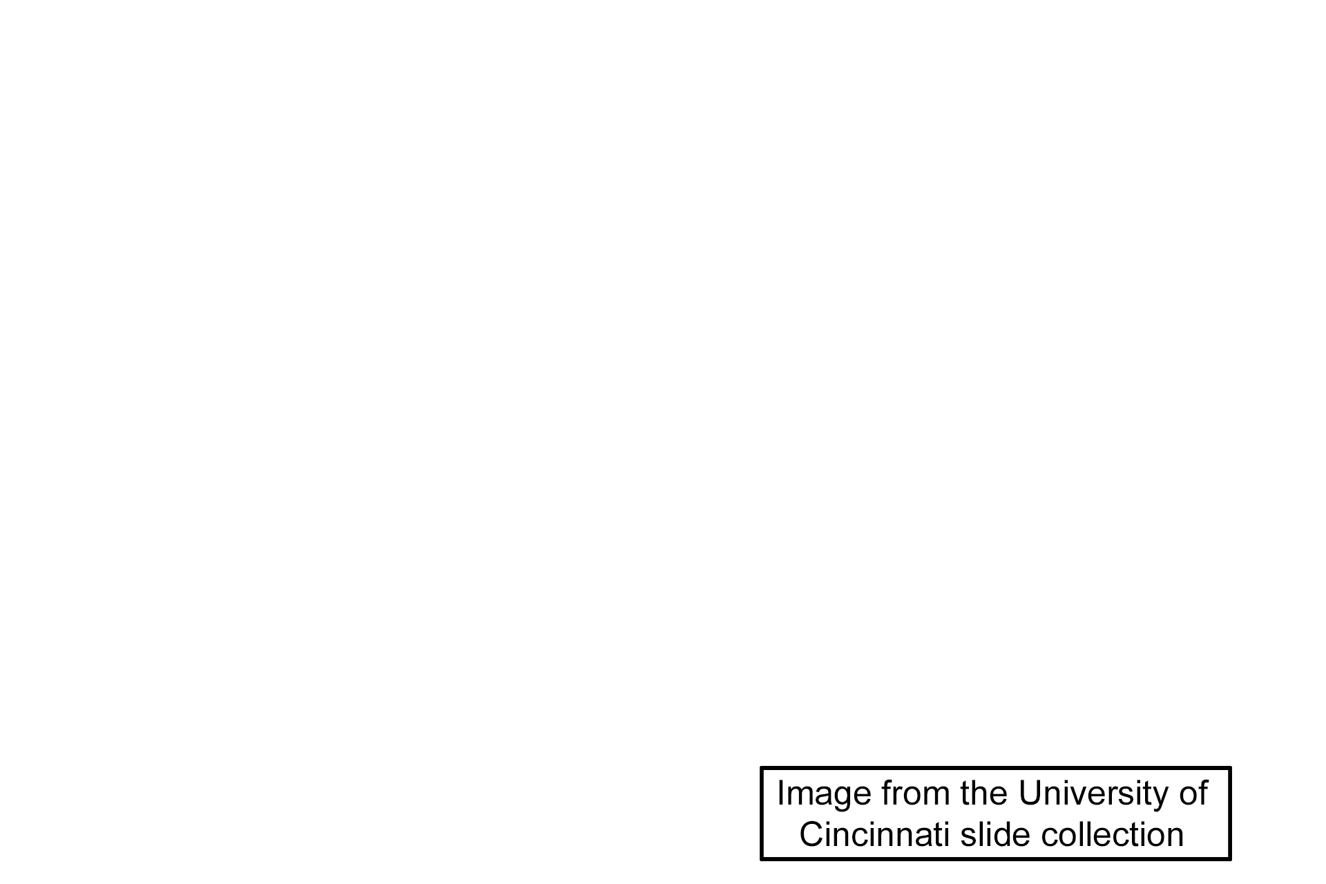 Image source > <p>Image taken of a slide in the University of Cincinnati collection.</p>
