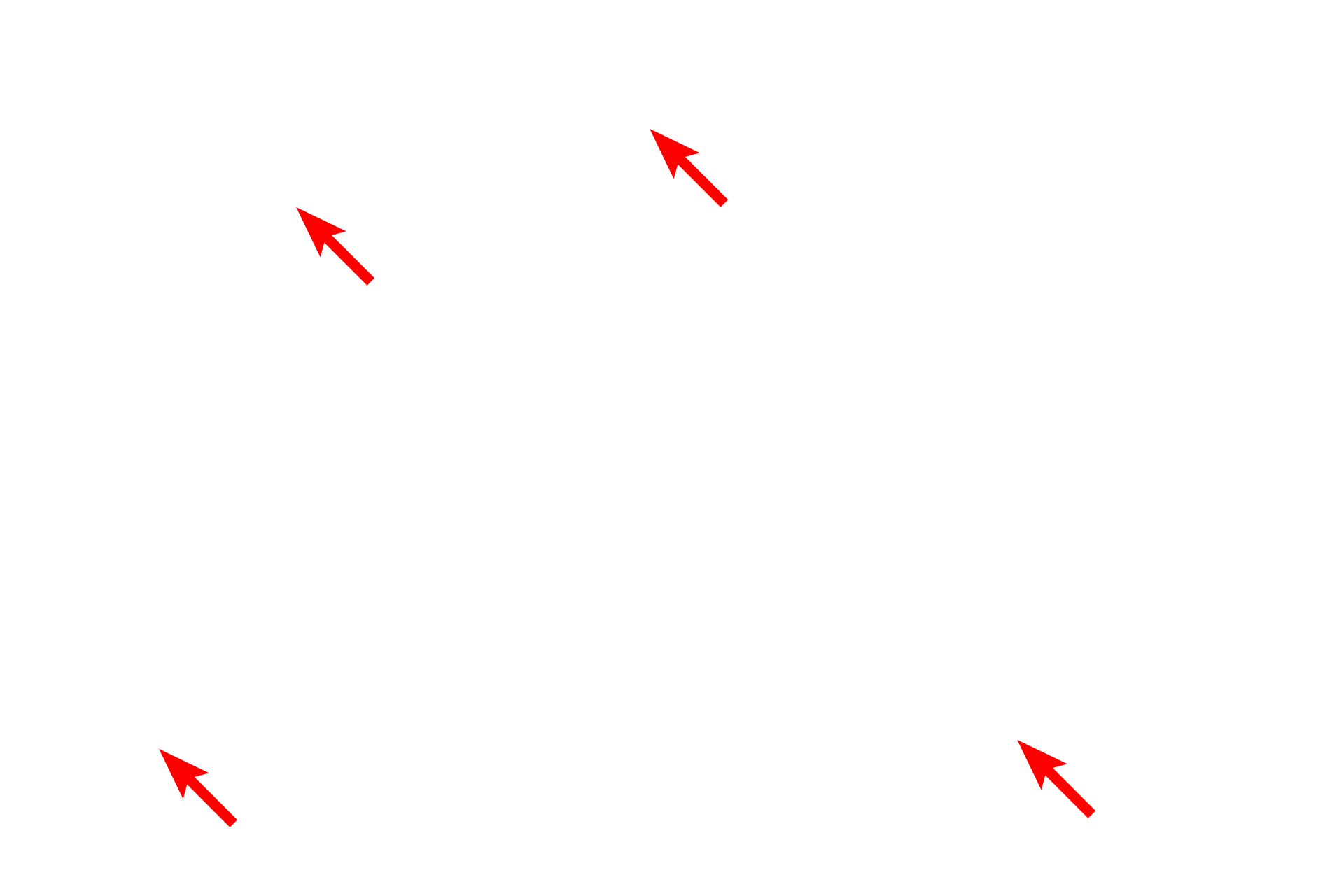 Glycogen <p>A stellate mucous connective tissue cell is seen in the center of this electron micrograph from the umbilical cord.  The euchromatic nucleus is surrounded by a pale-staining cytoplasm that contains relatively sparse organelles and glycogen.  In some cells these organelles are concentrated at the poles of the nucleus.  The extracellular matrix contains few, very thin collagen fibers and abundant, gelatinous ground substance.<br />
15,000x</p>
