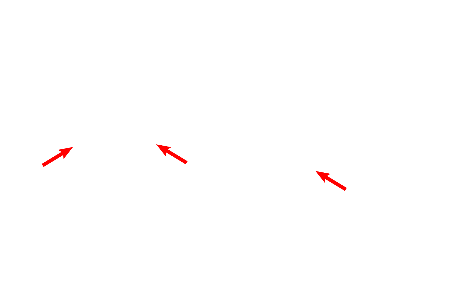 Cochlea > <p>The cochlea is the portion of the osseous labyrinth that is coiled into a spiral of 2.5 turns, resembling a snail shell. The portion of the membranous labyrinth housed within the cochlea is the cochlear duct, containing the receptor for sound, the organ of Corti.</p>
